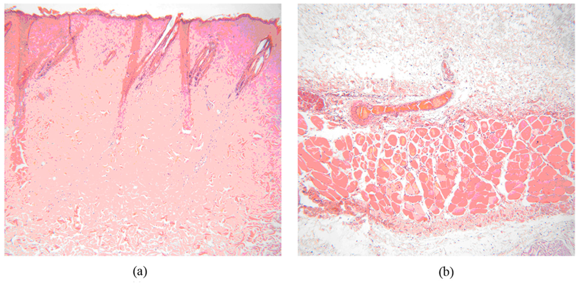 Marinedrugs 15 00102 g004