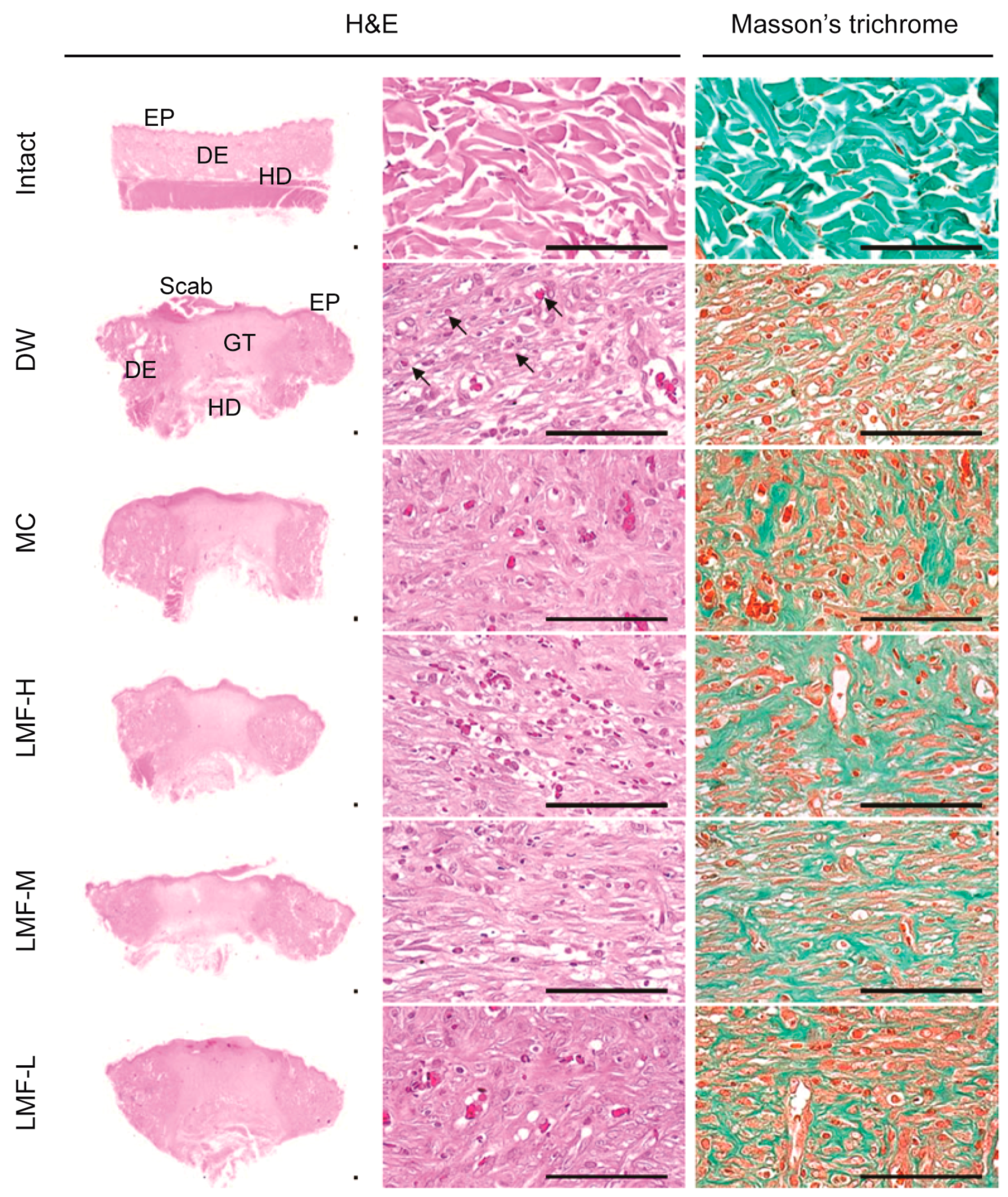 Marinedrugs 15 00112 g004