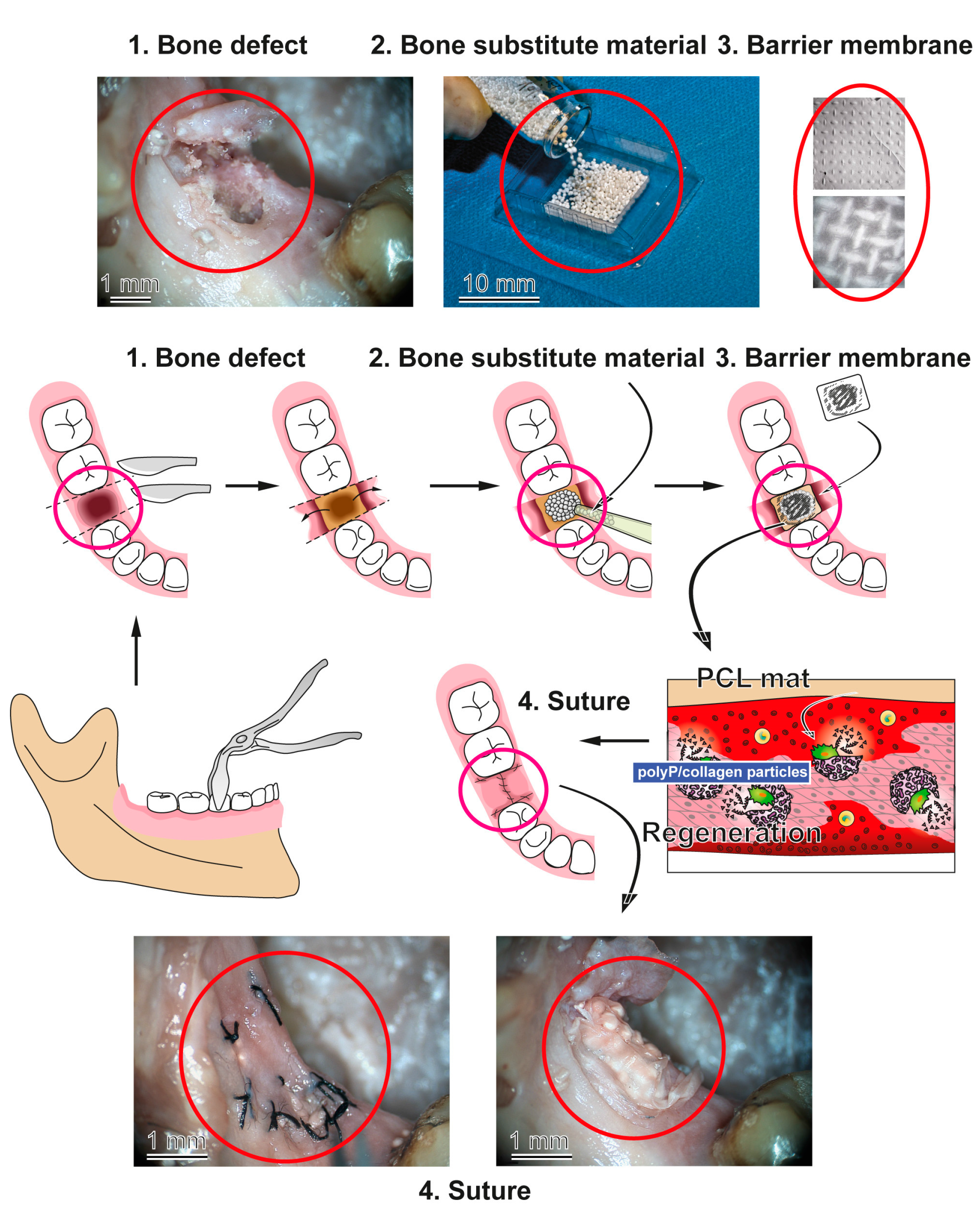 Marinedrugs 15 00142 g009 550