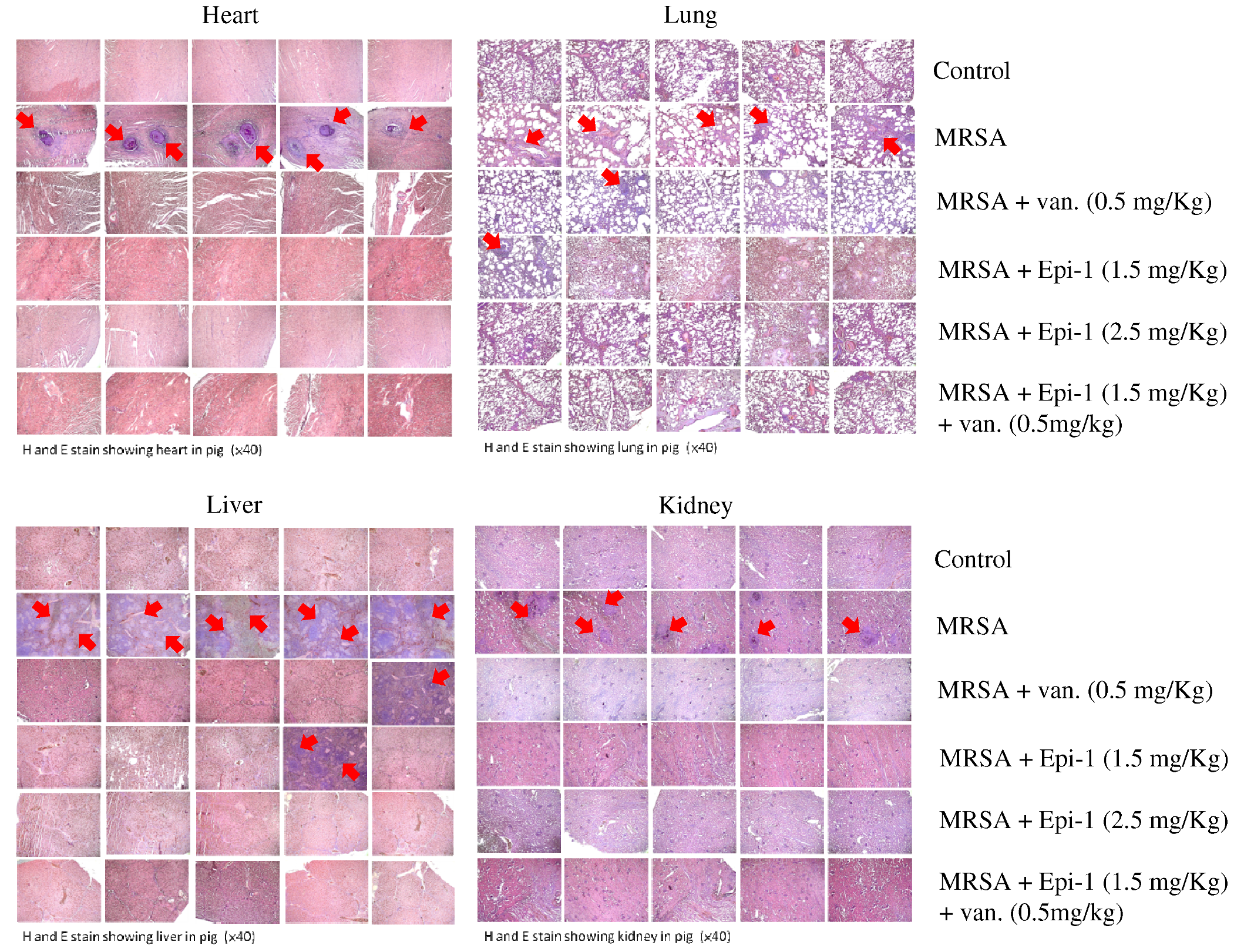 Marine Drugs | Free Full-Text | Epinecidin-1 Protects against Methicillin Resistant Staphylococcus aureus Infection and Sepsis in Pyemia Pigs | HTML Marine Drugs | Free Full-Text | Epinecidin-1 Protects against Methicillin Resistant Staphylococcus aureus Infection and Sepsis in Pyemia Pigs | HTML