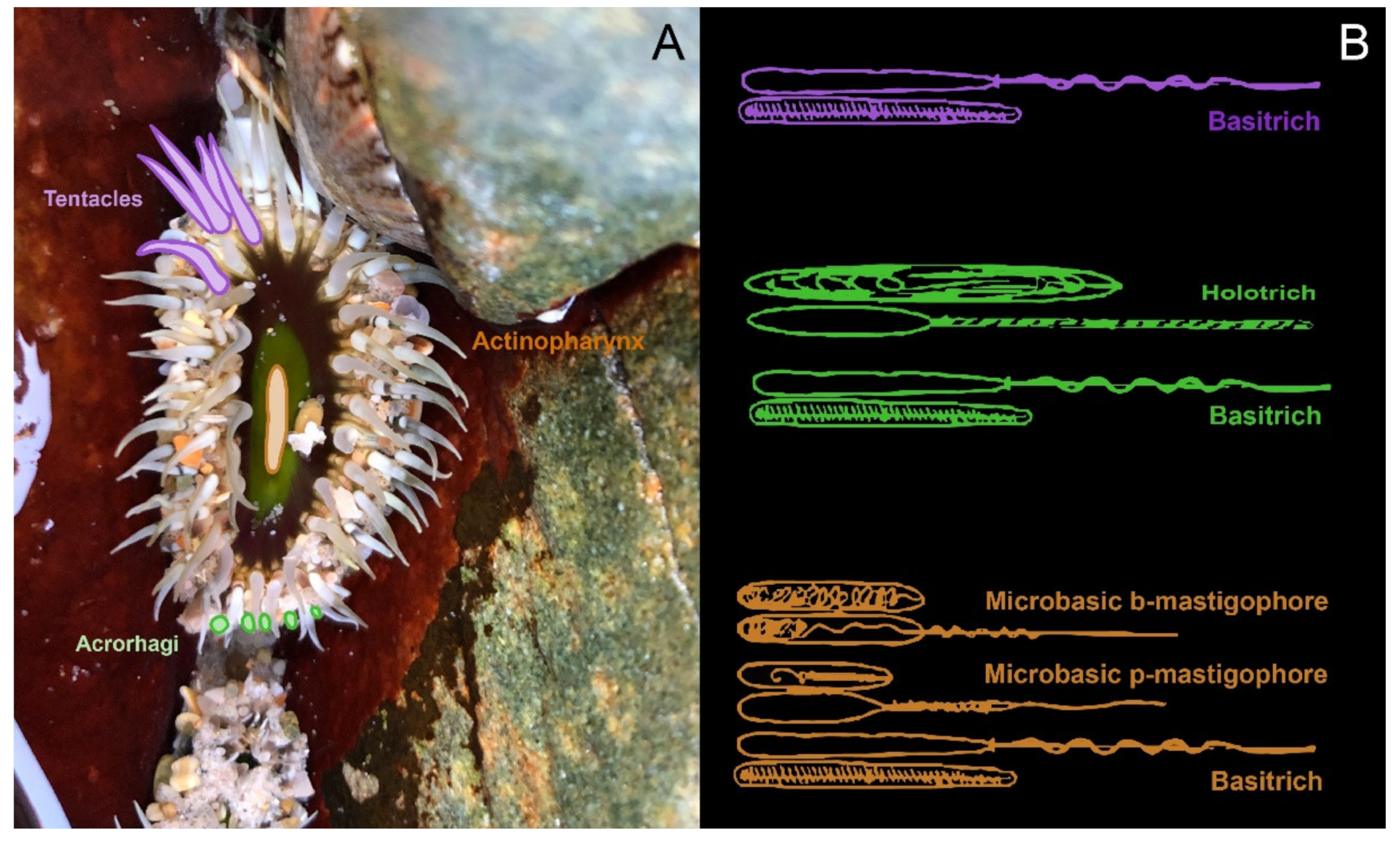 sea anemone labeled diagram