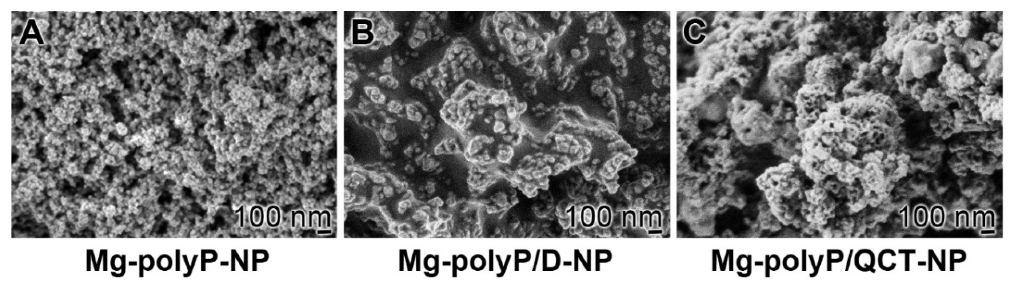 Caged Dexamethasone/Quercetin Nanoparticles, Formed of the
