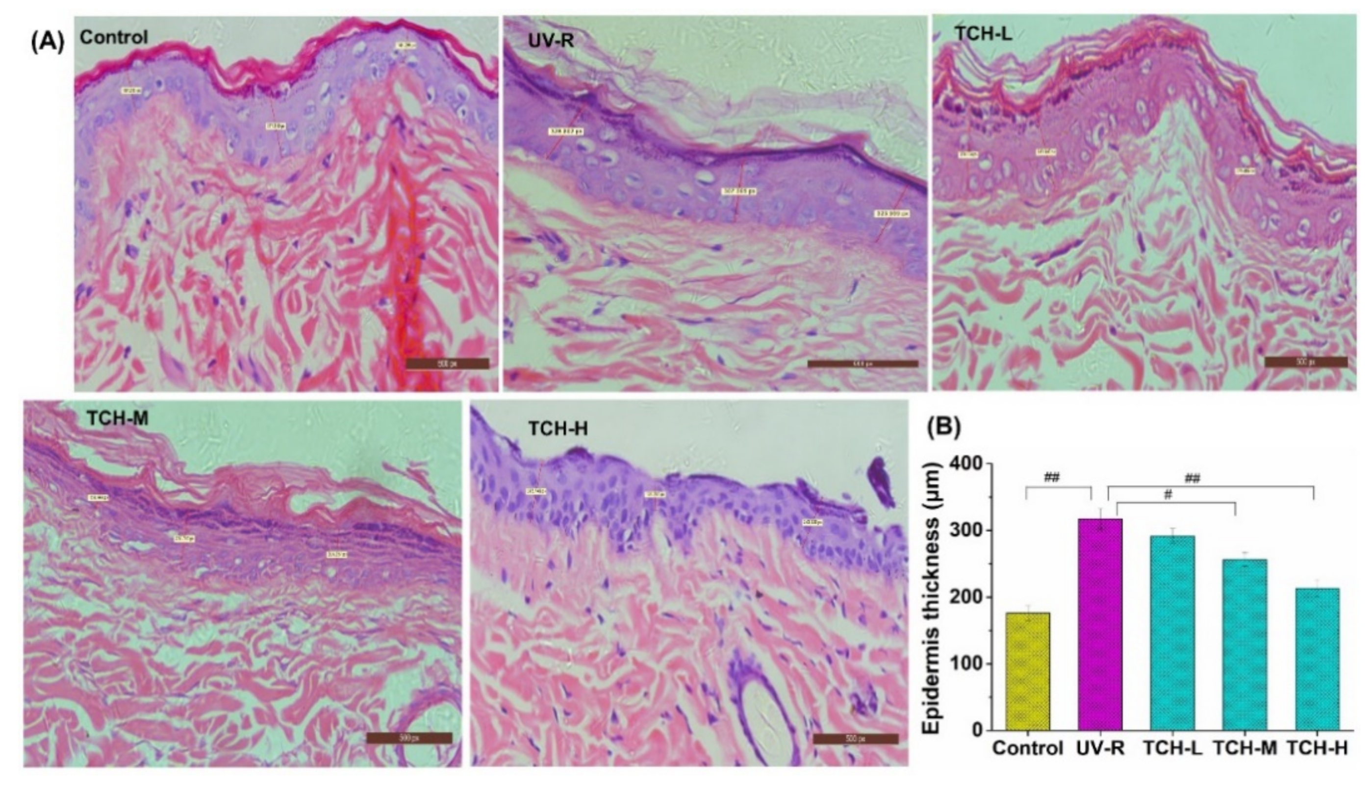 Marinedrugs 20 00252 g004