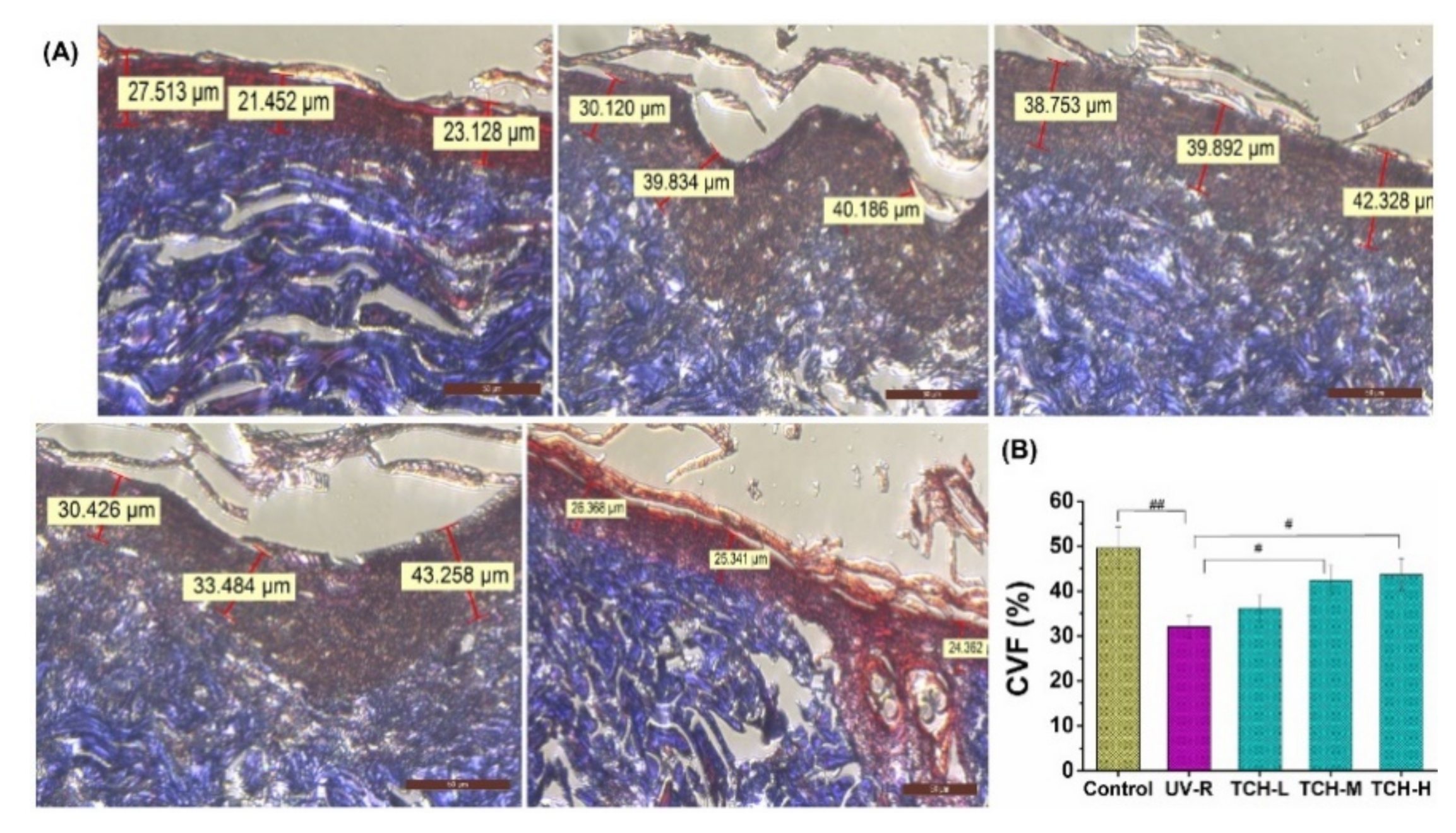 Marinedrugs 20 00252 g005