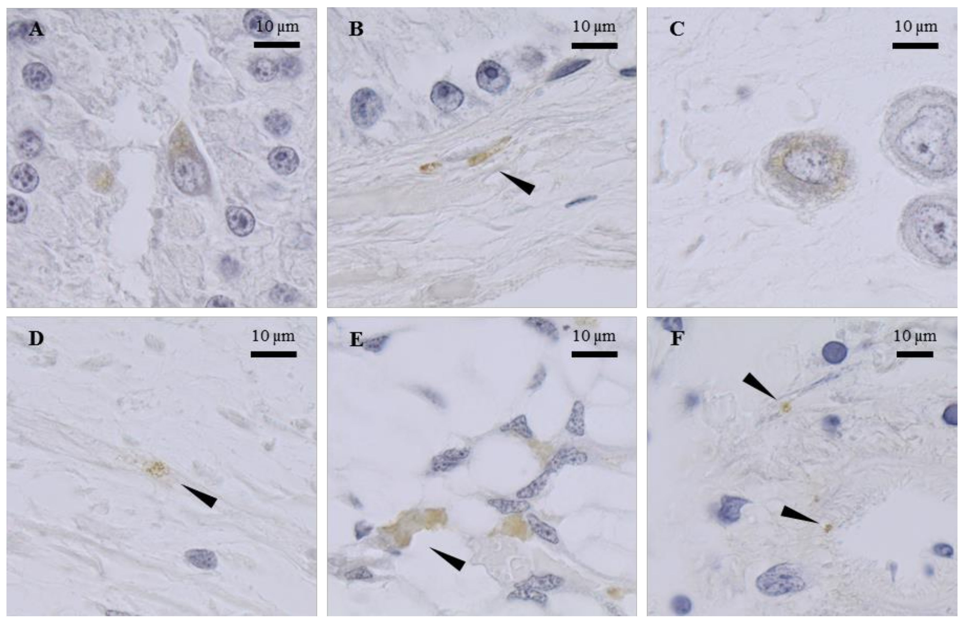 Marinedrugs 20 00505 g003 Marinedrugs 20 00505 g003