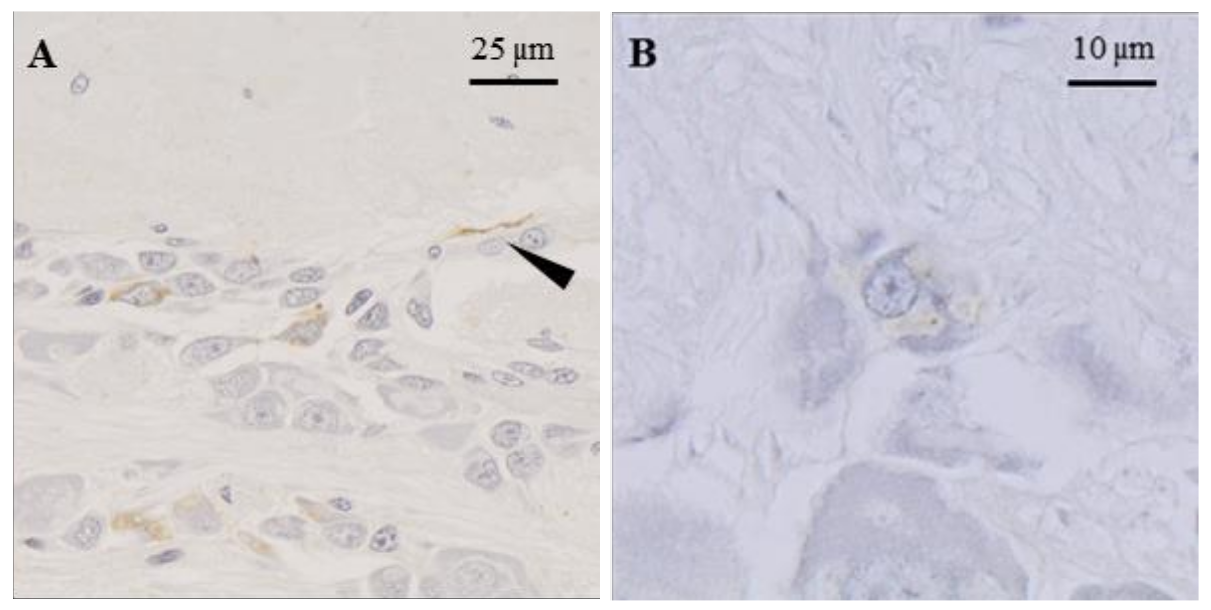 Marinedrugs 20 00505 g004 Marinedrugs 20 00505 g004