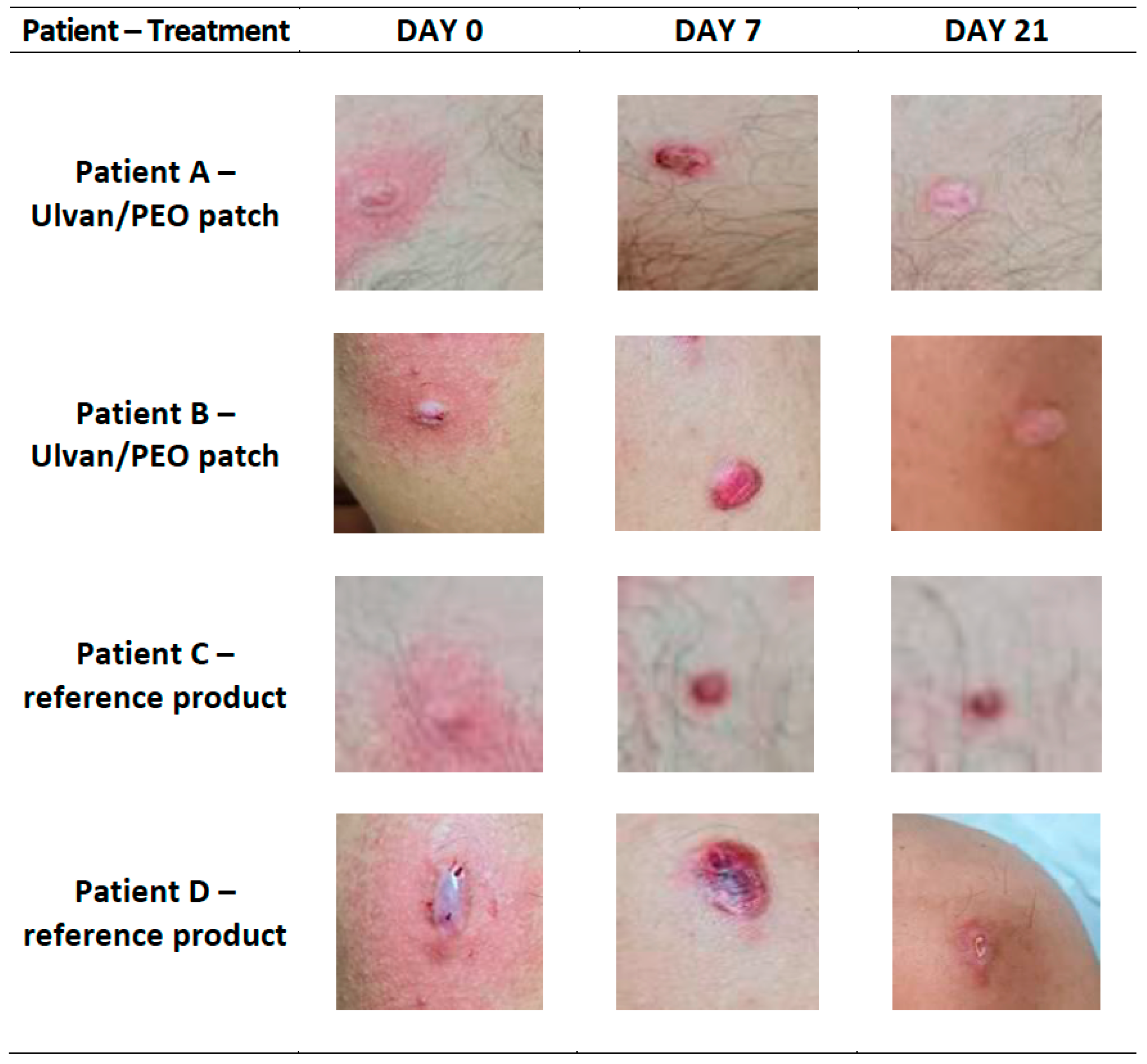 Marinedrugs 20 00551 g003 Marinedrugs 20 00551 g003