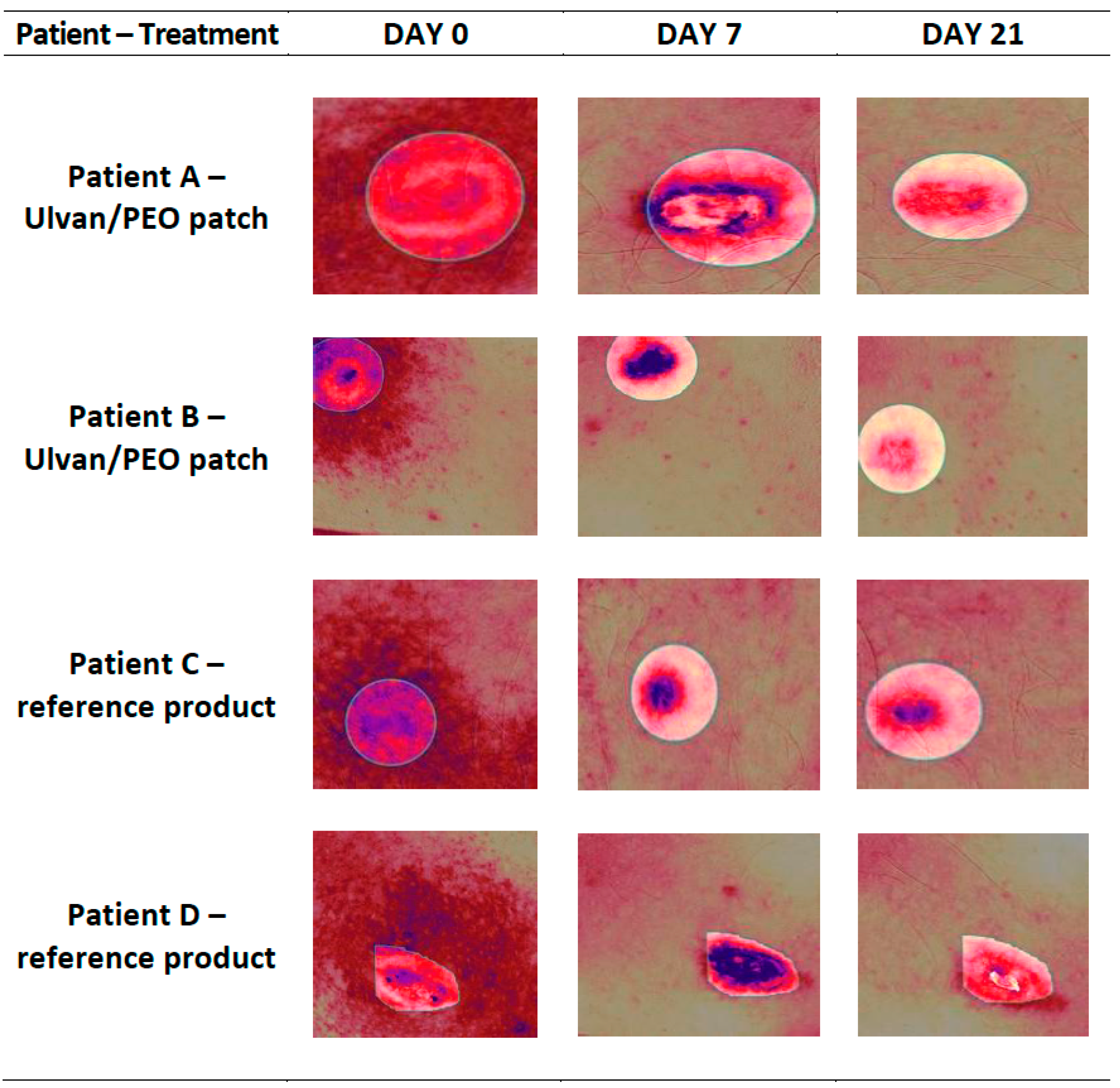 Marinedrugs 20 00551 g005 Marinedrugs 20 00551 g005