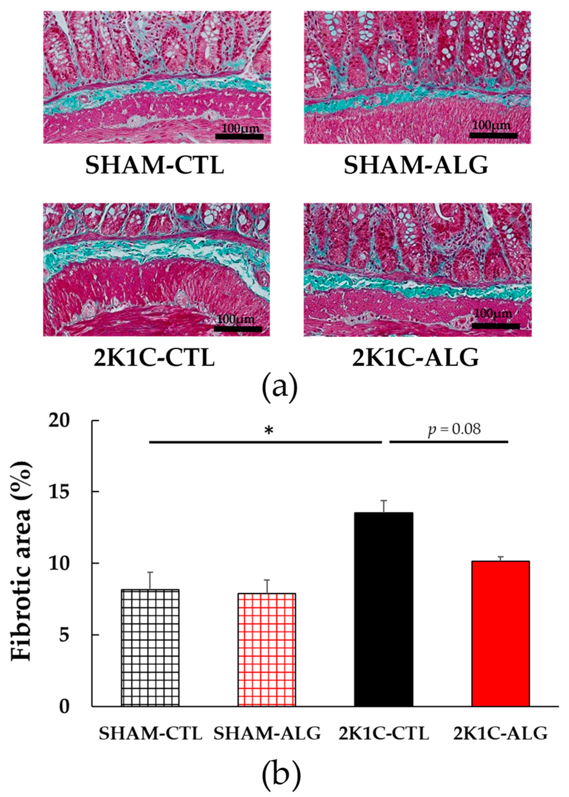 Marinedrugs 21 00324 g003 Marinedrugs 21 00324 g003