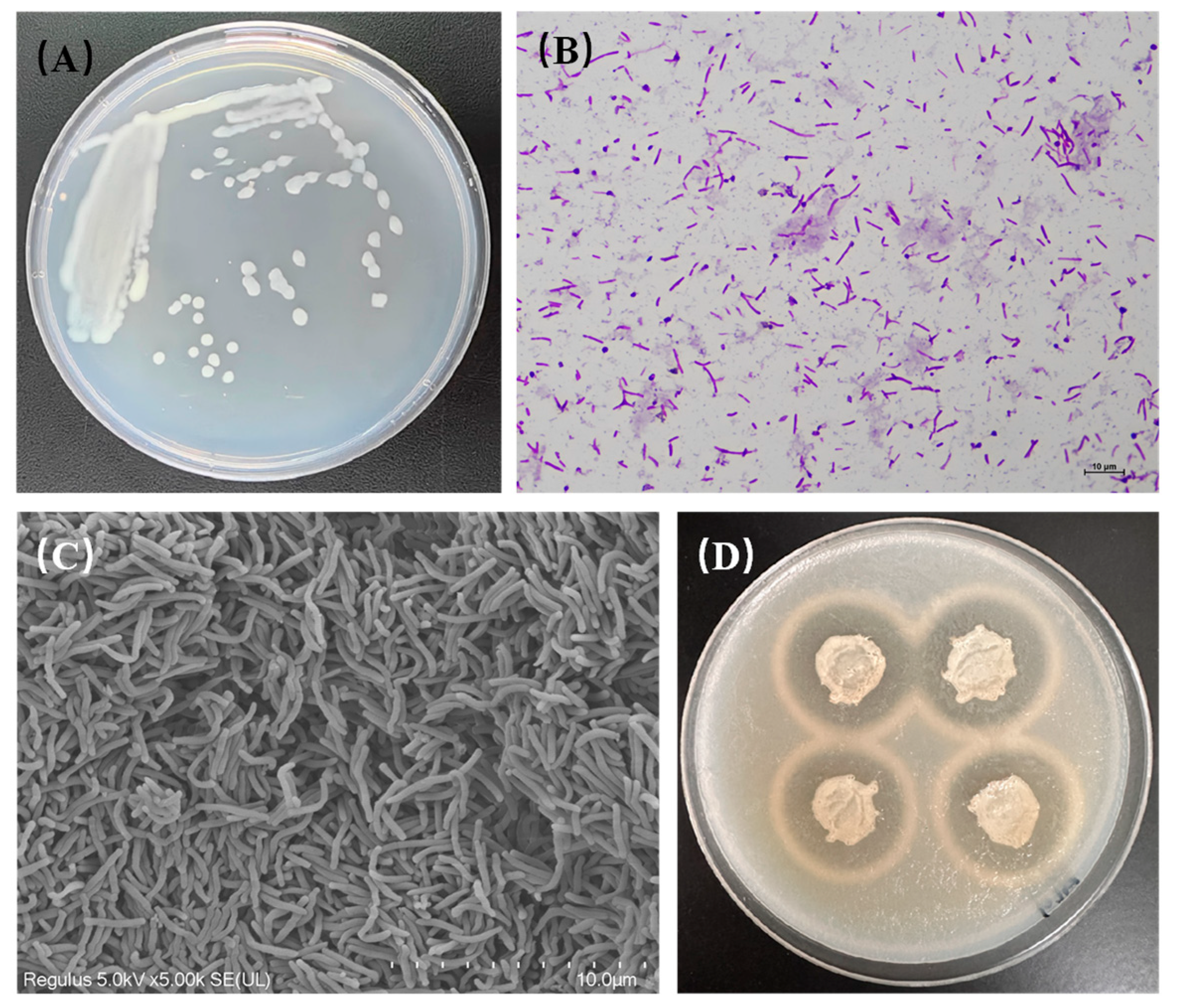 Genome Analysis of a Polysaccharide-Degrading Bacterium