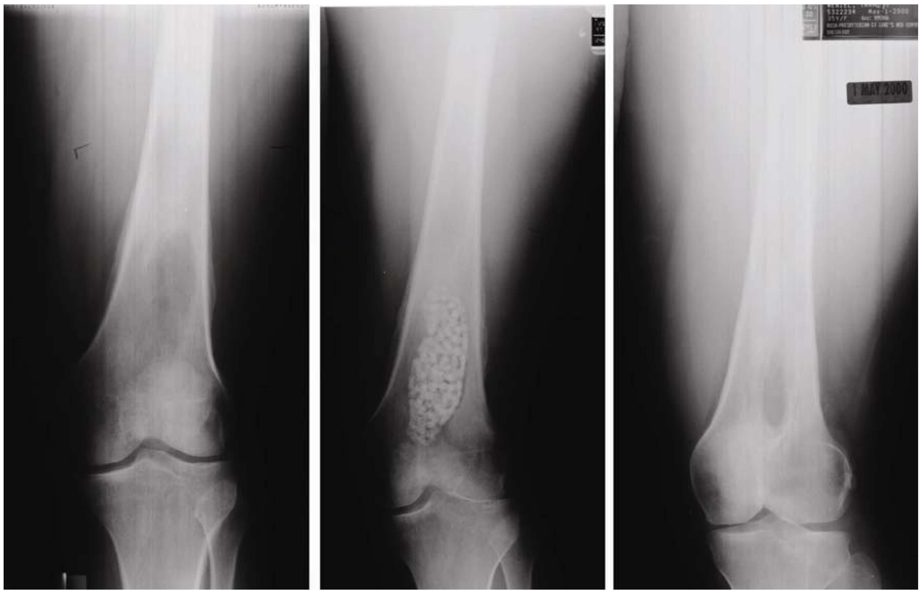 Materials 03 01138 g005 1024