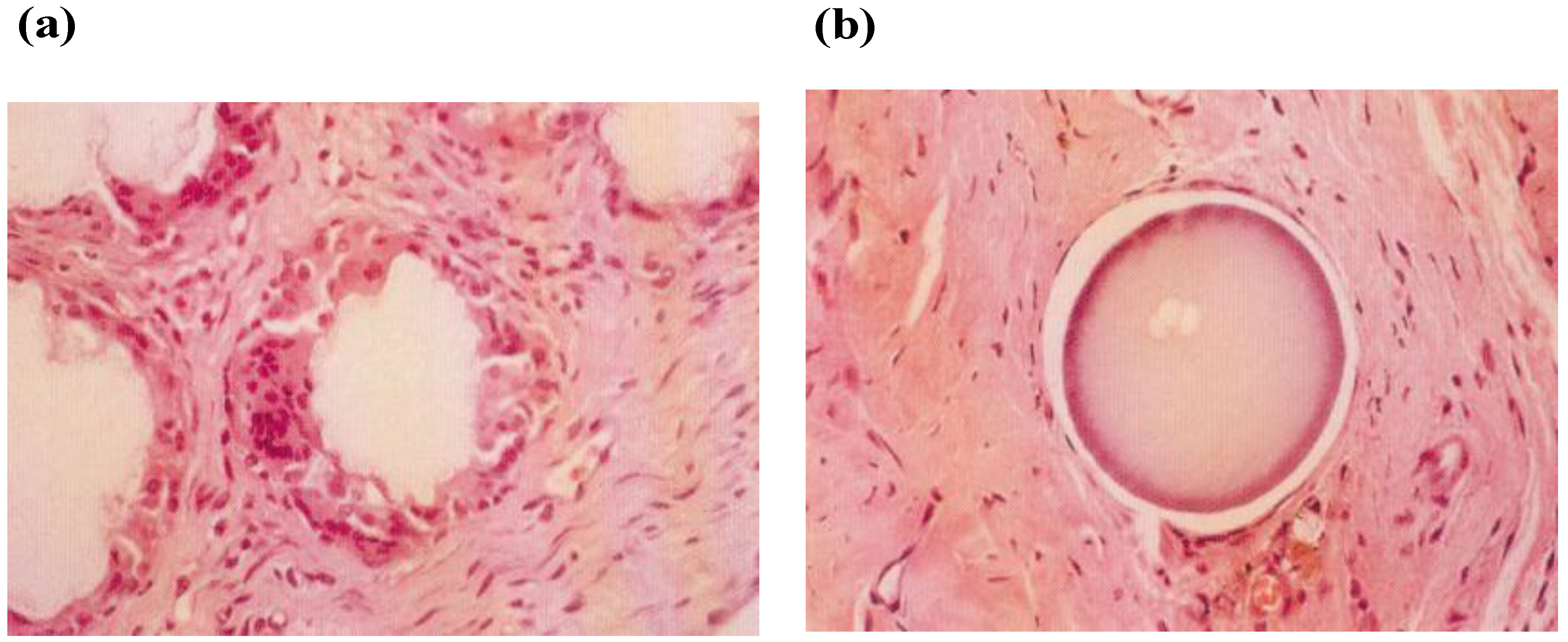 Materials 03 02753 g002 1024