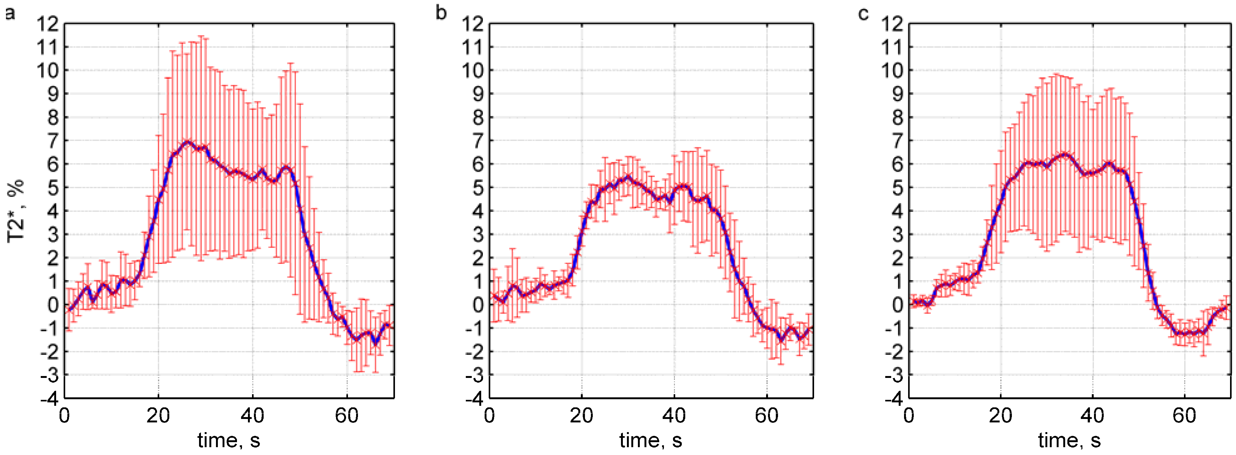 Materials 04 01548 g004