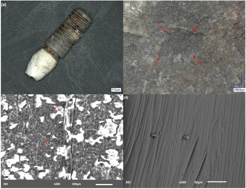 Materials Special Issue Titanium Materials for Biomedical