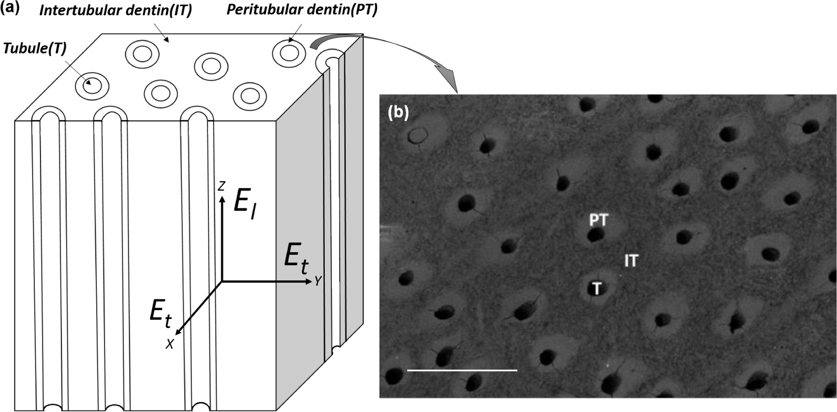 Materials | Free Full-Text | A New Method Combining Finite Element Analysis  and Digital Image Correlation to Assess Macroscopic Mechanical Properties  of Dentin