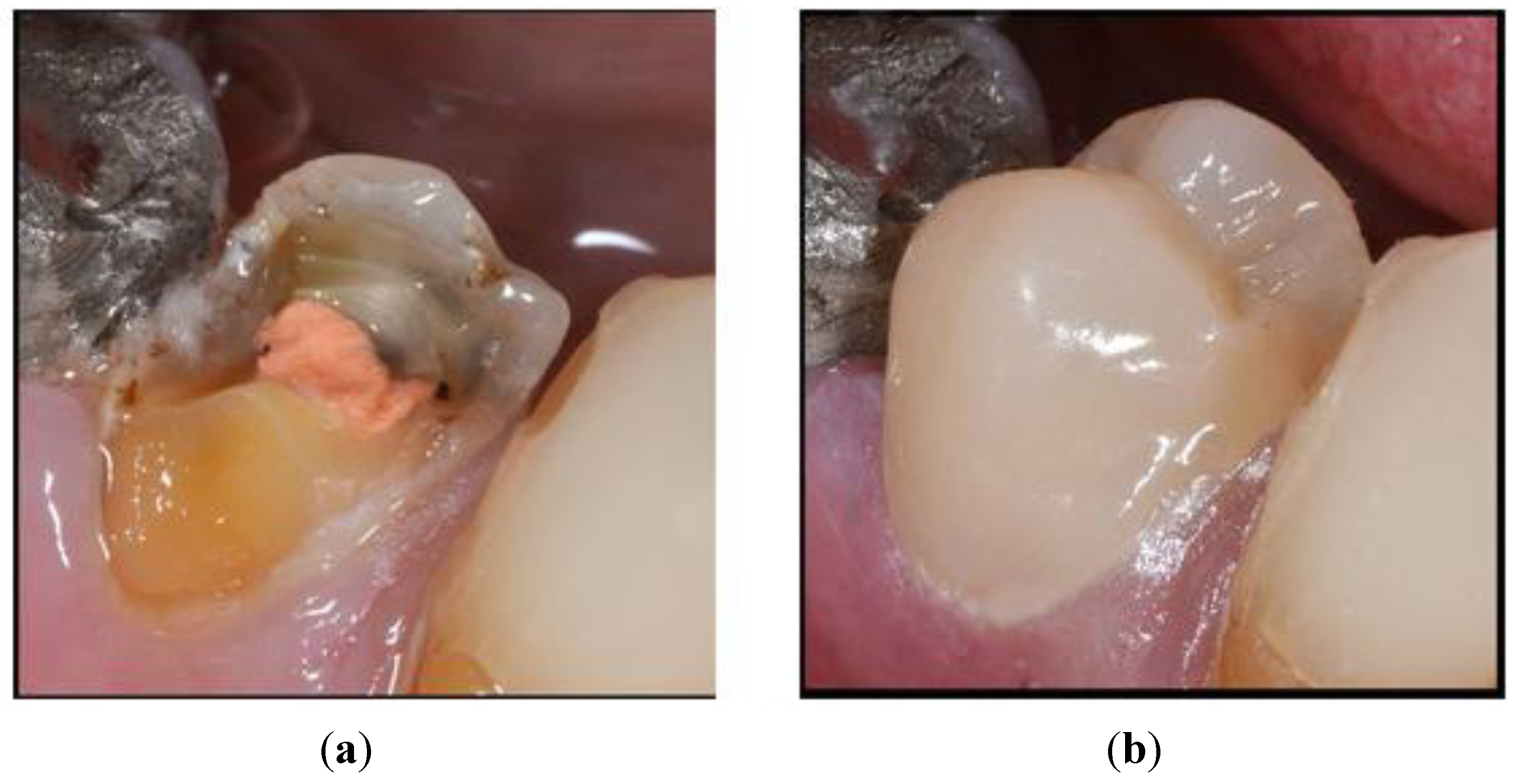 Materials Free FullText Advances in Nanotechnology for Restorative