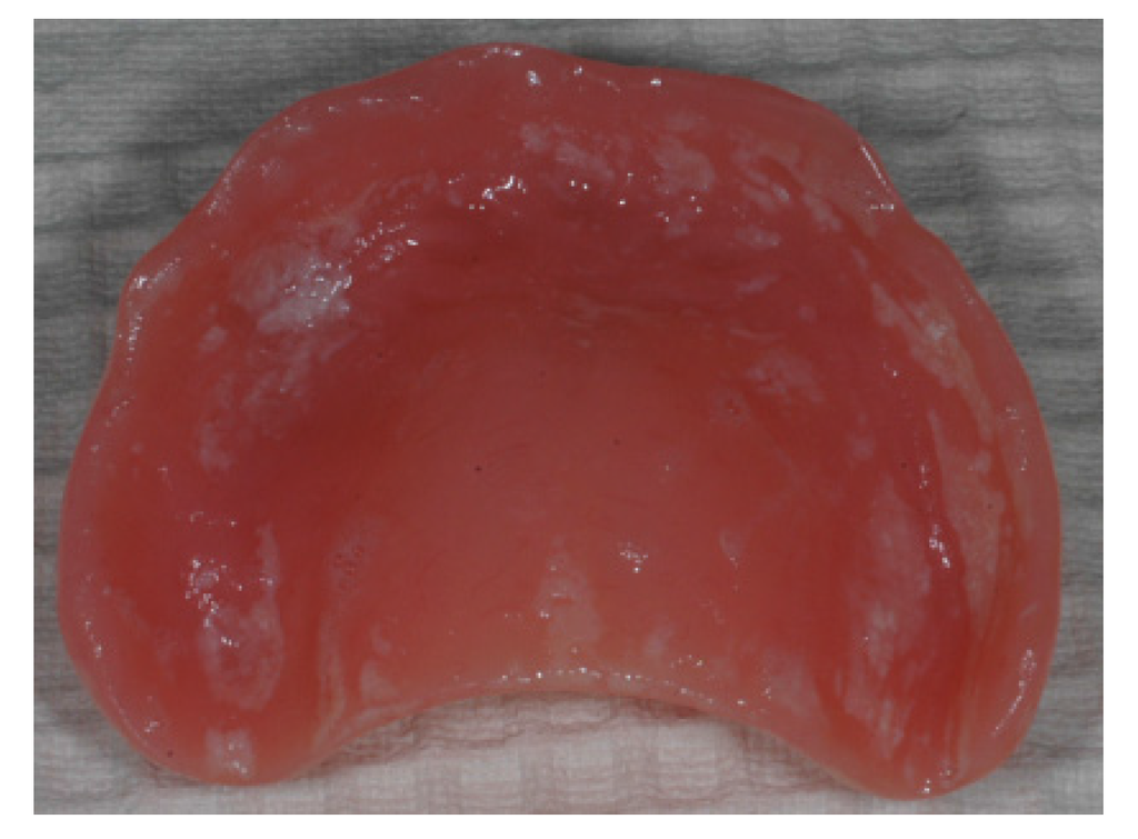Materials Free FullText Biofilm and Dental Biomaterials
