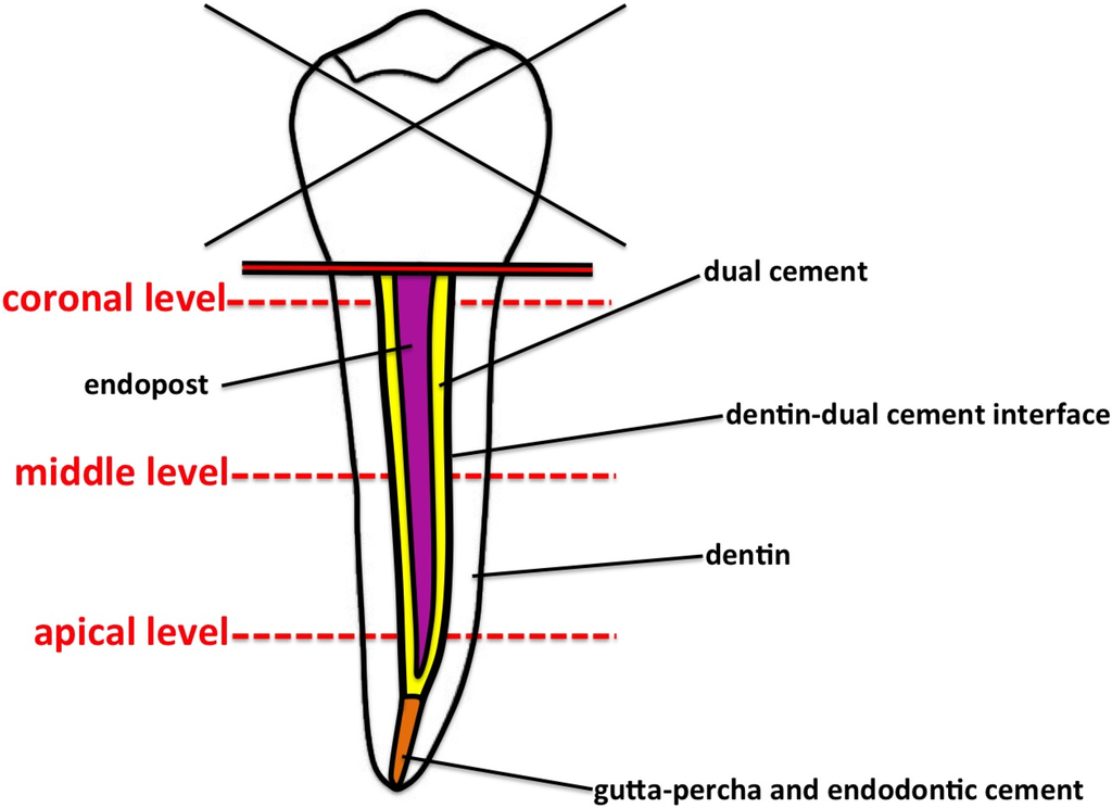 Materials Free Full Text Quantitative Analysis Of Defects At The Dentin Post Space In Endodontically Treated Teeth Html