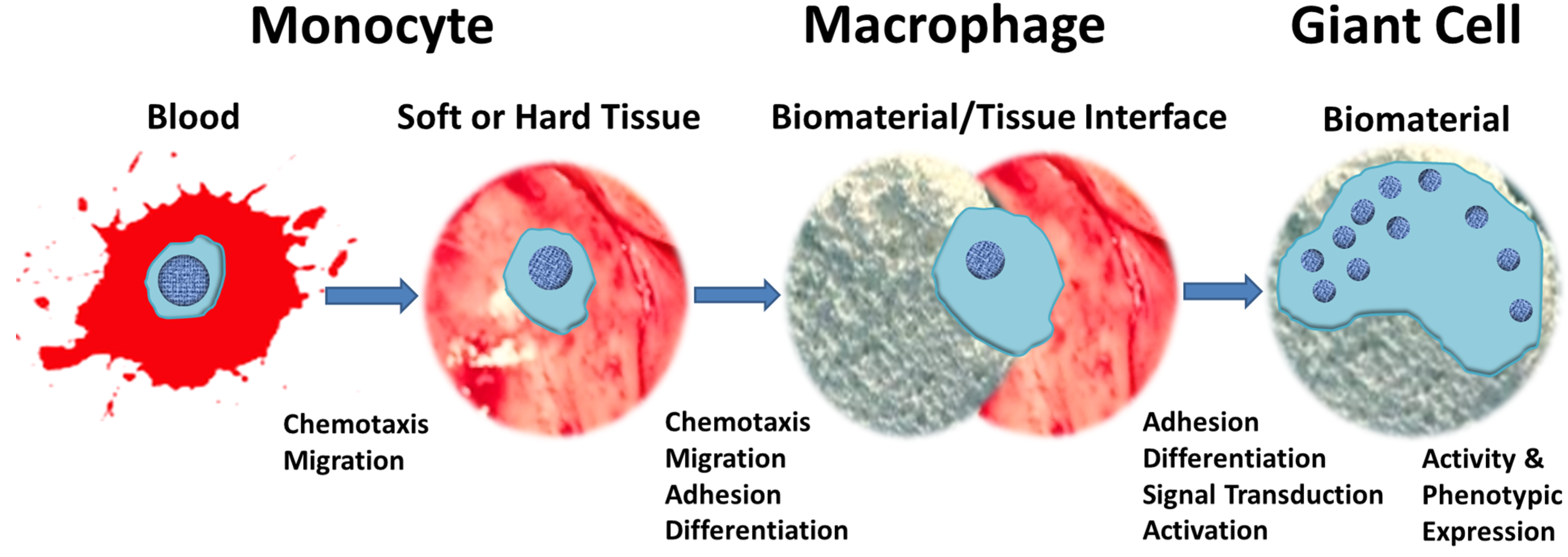 Frontiers  Foreign Body Reaction to Implanted Biomaterials and