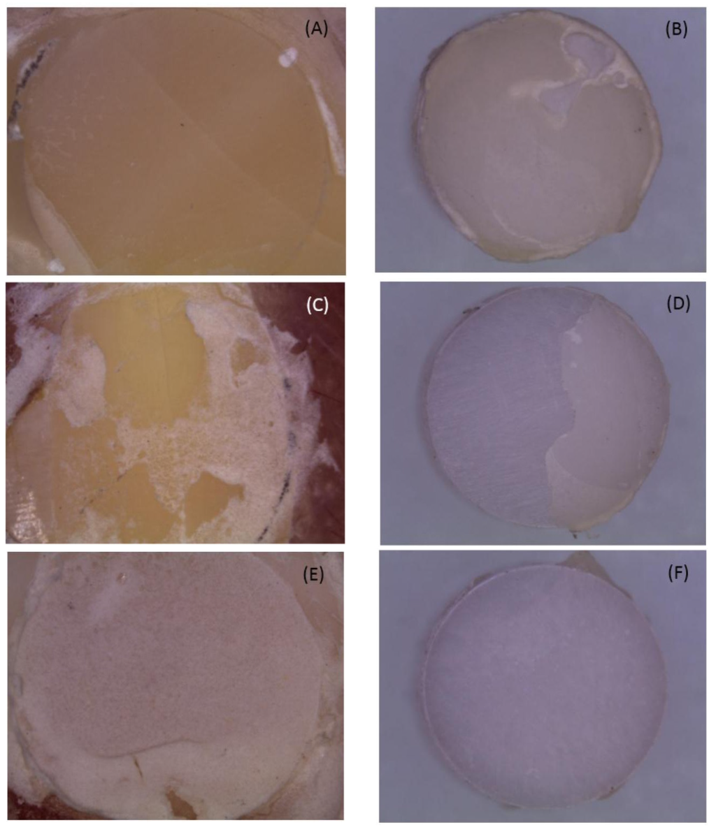 Influence of HotEtching Surface Treatment on Zirconia/Resin Shear Bond