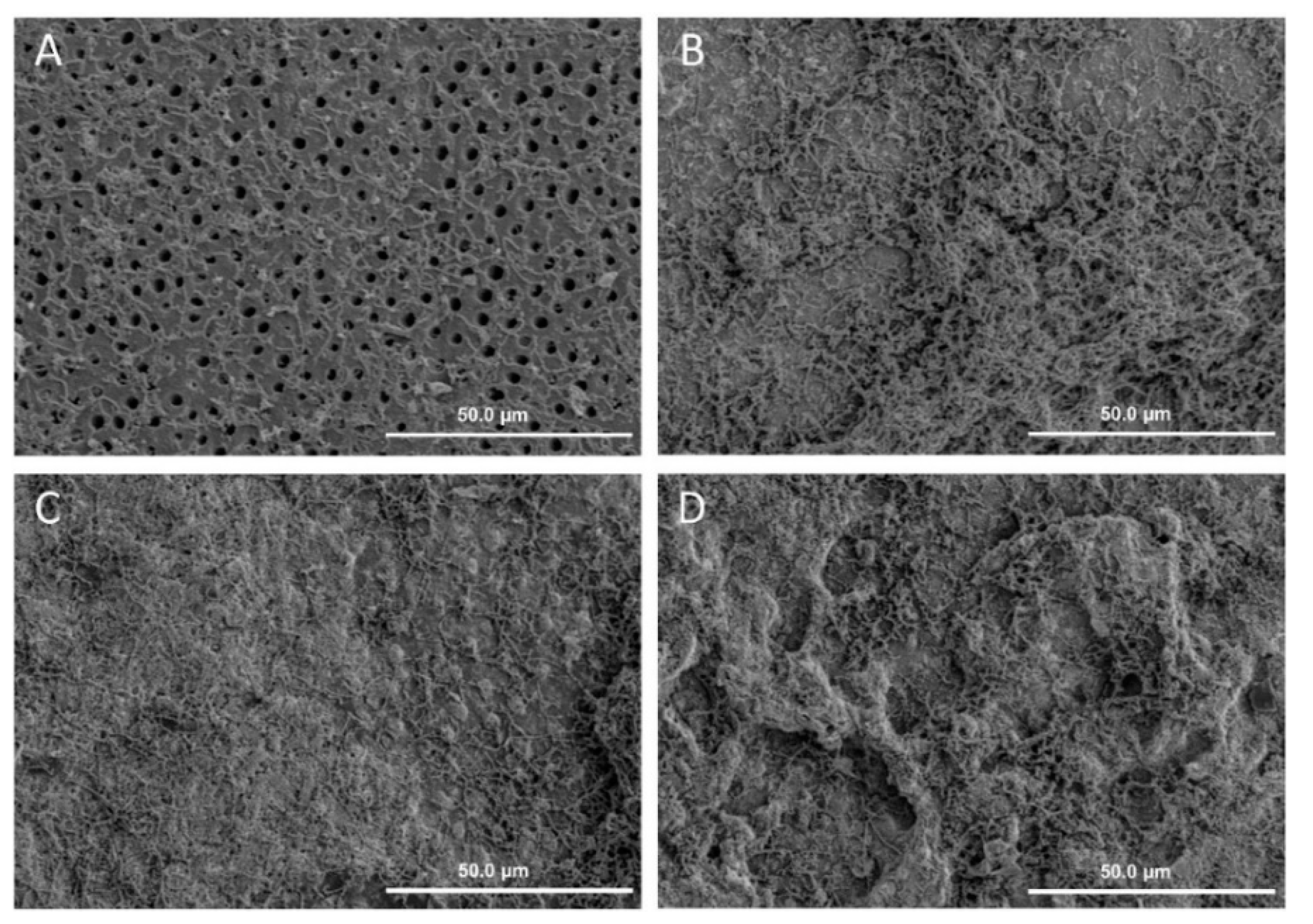 Materials Free FullText Inhibition of Cariogenic Plaque Formation