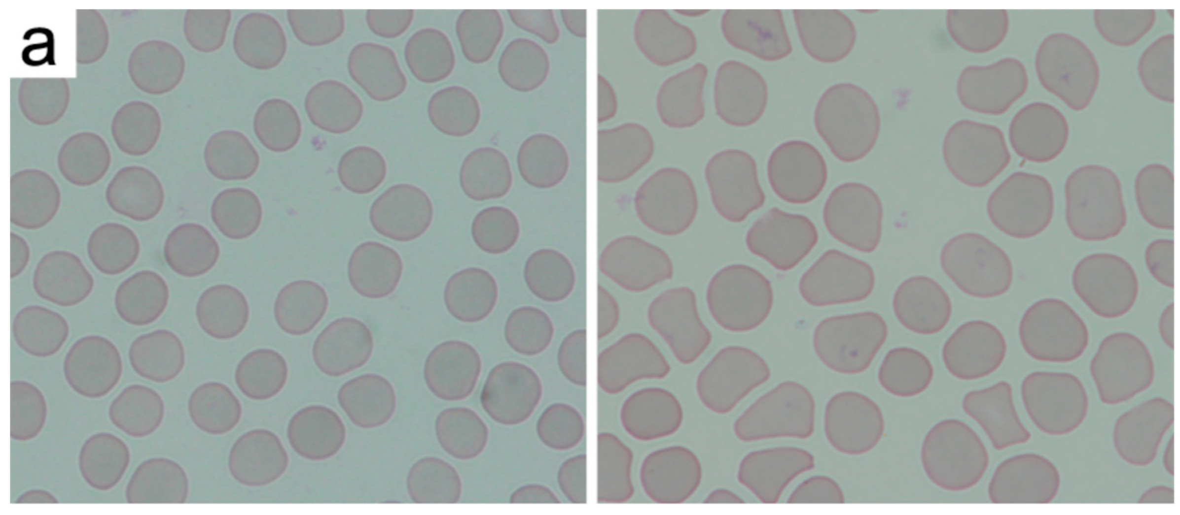 Materials 10 00352 g004a