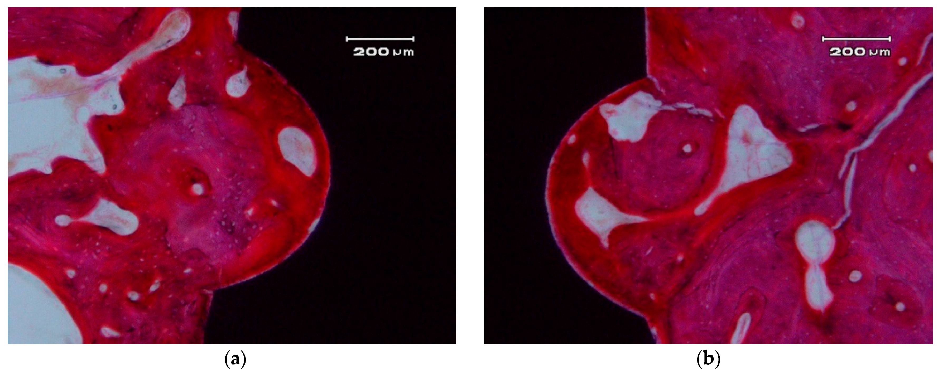 Materials 10 00614 g006