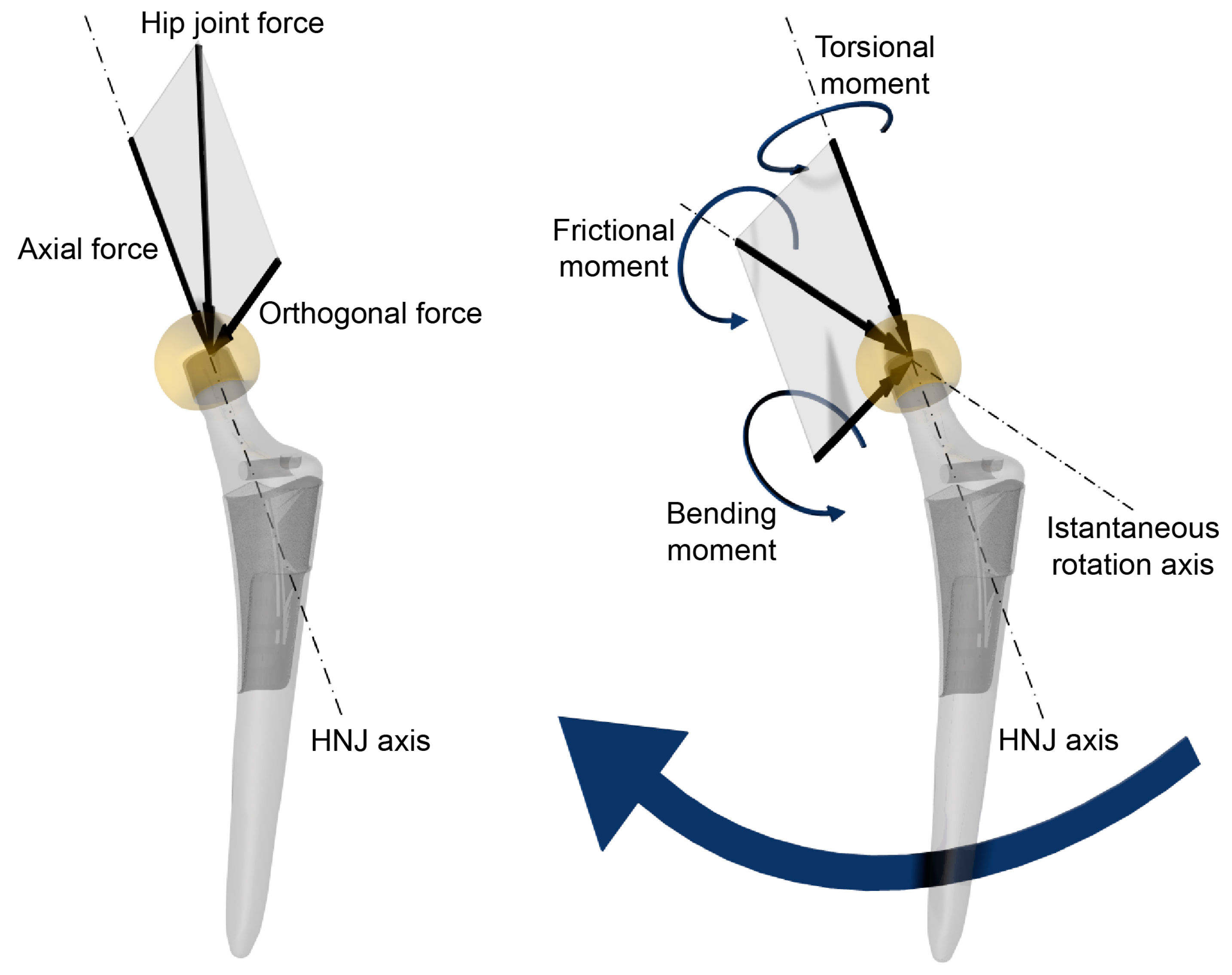 materials free full text in vivo damage of the head hip replacements materials