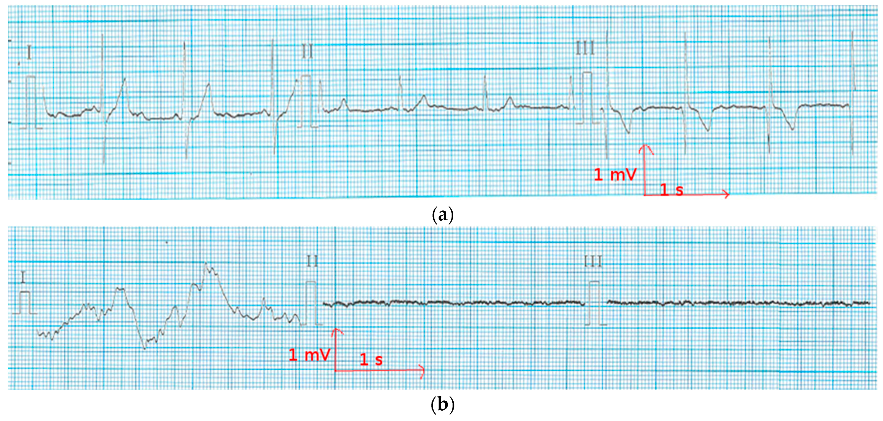 Materials 11 00256 g009a