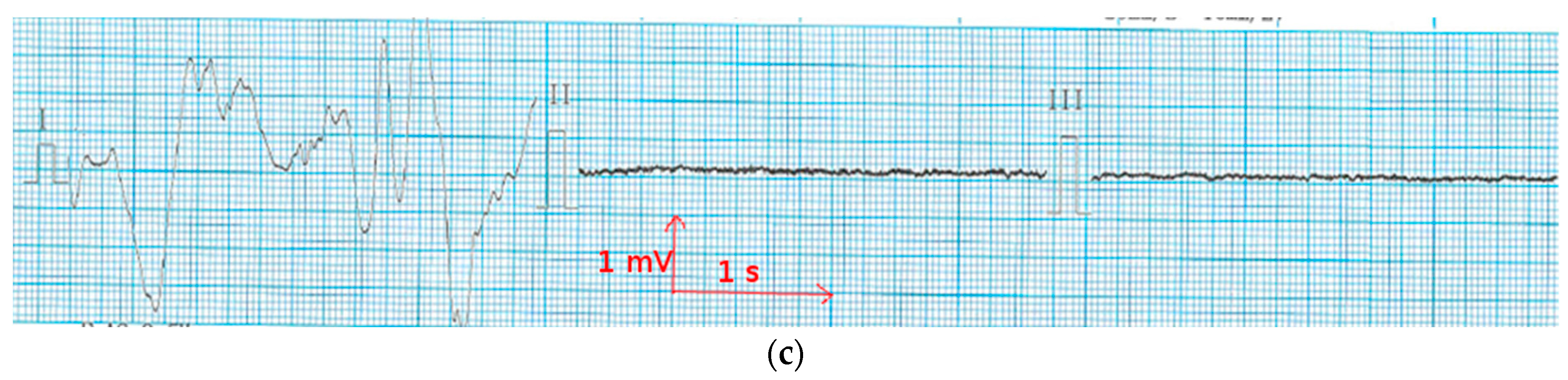 Materials 11 00256 g009b