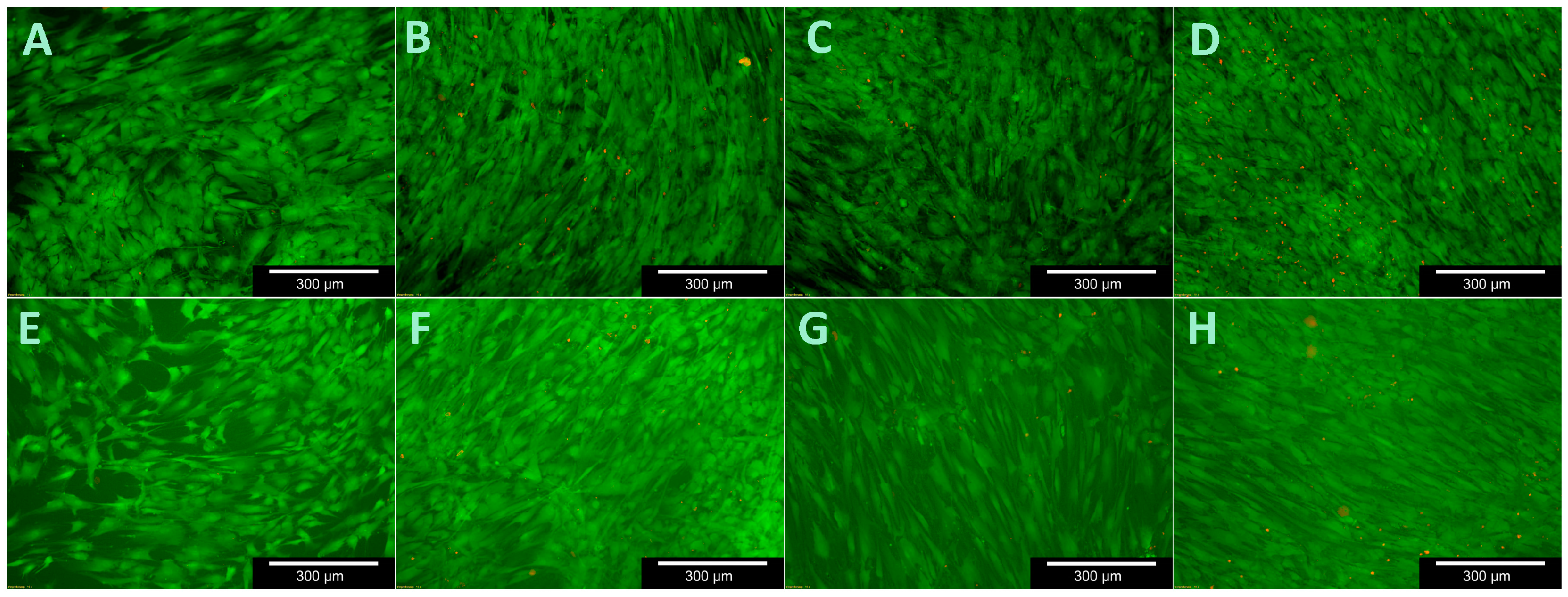 Materials 11 00316 g009 550