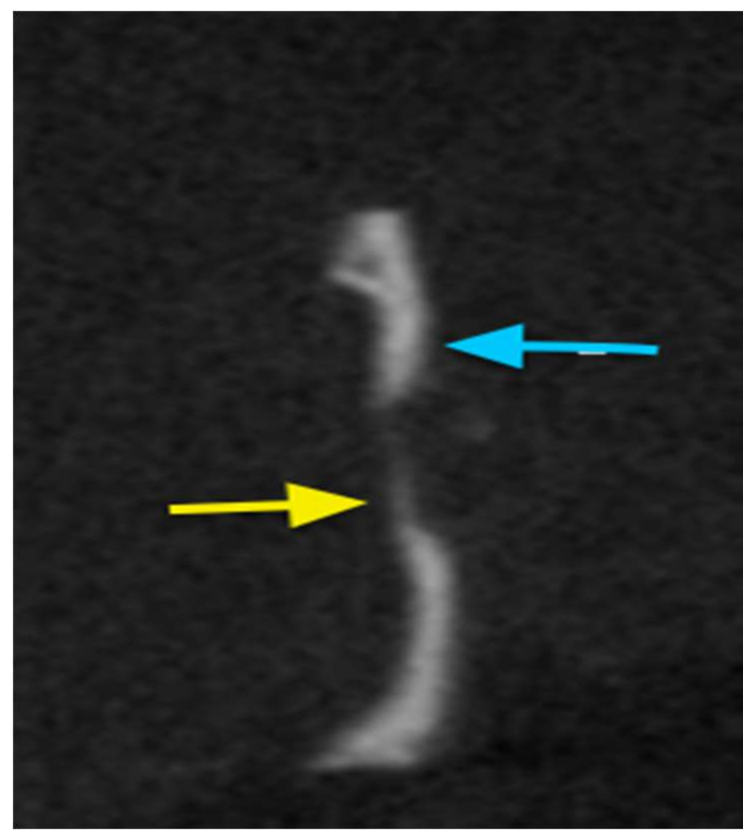 Materials 11 00521 g012 Materials 11 00521 g012