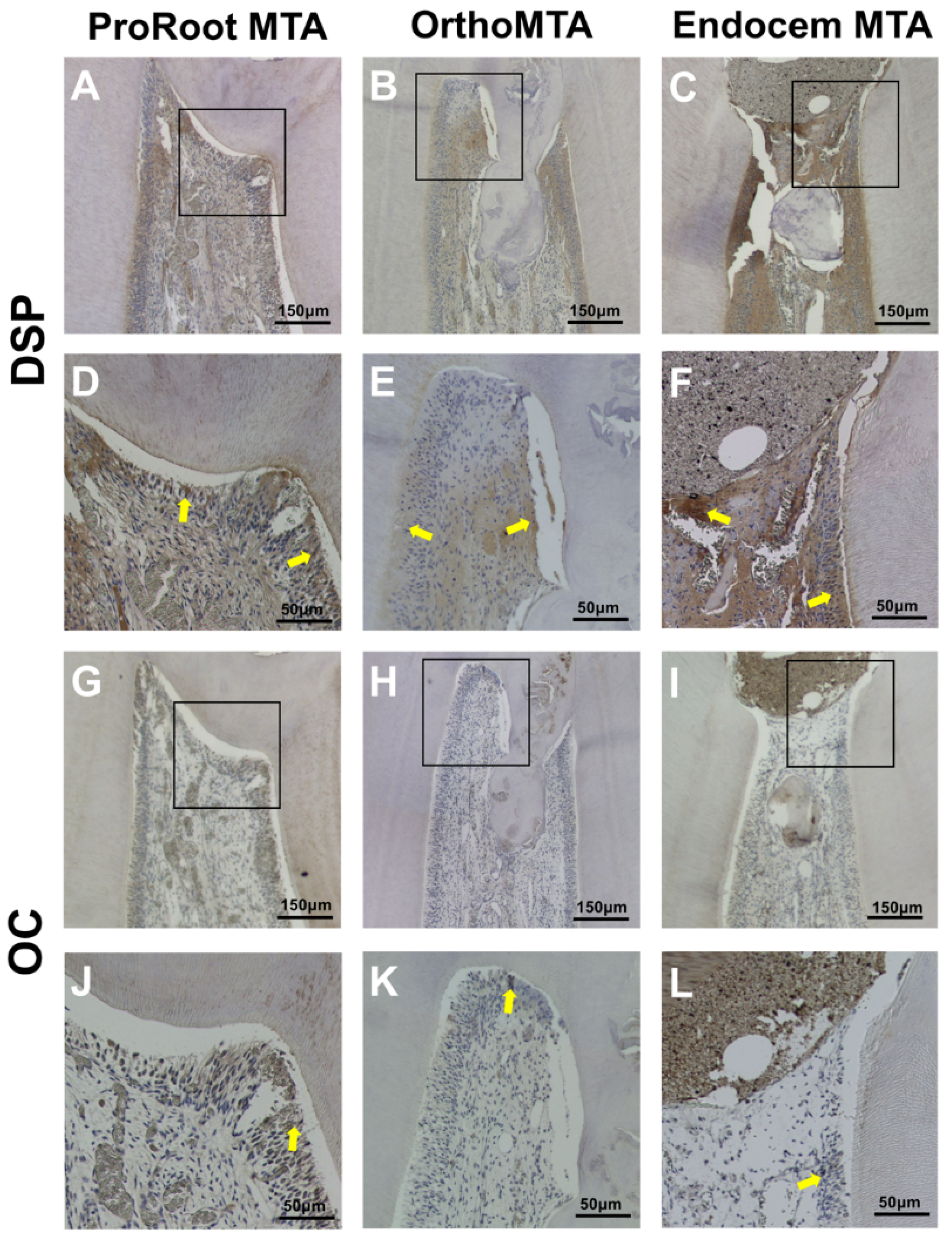 Materials 11 00899 g004