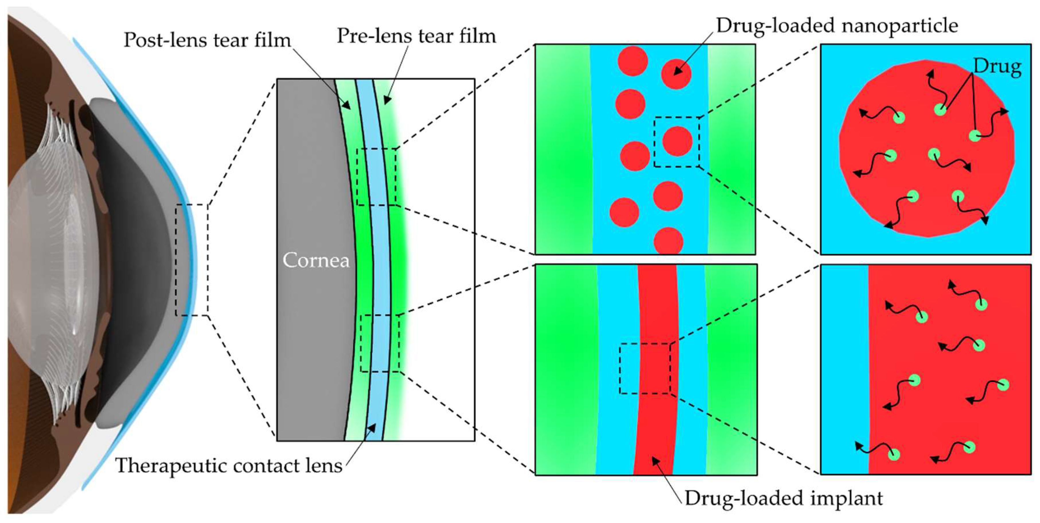 review of cornea and contact lens book review of cornea and contact lens book