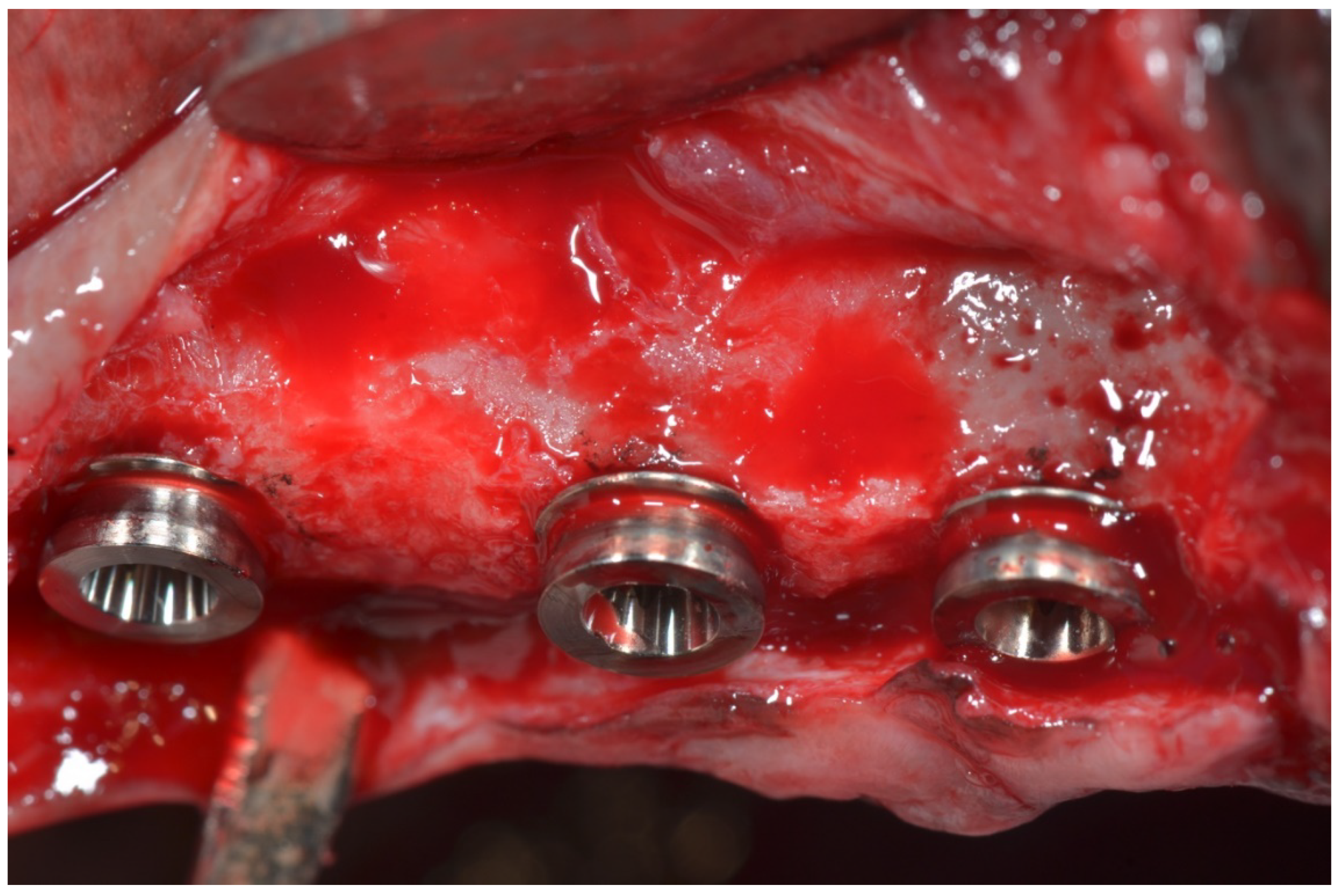 Materials 11 01630 g003