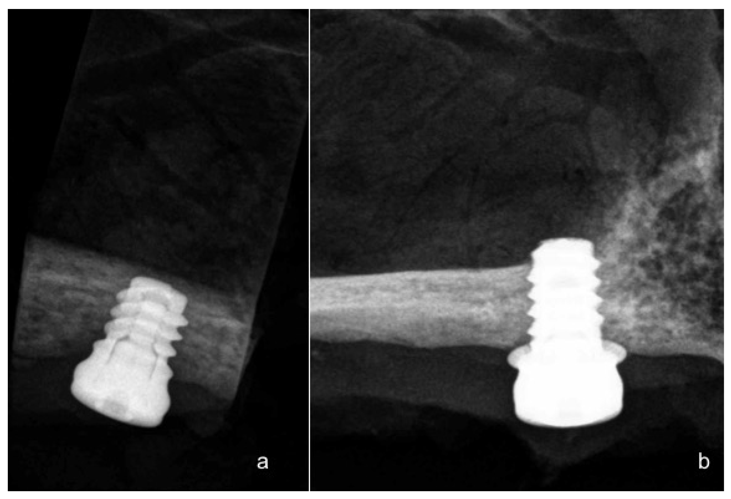Materials 11 01630 g004