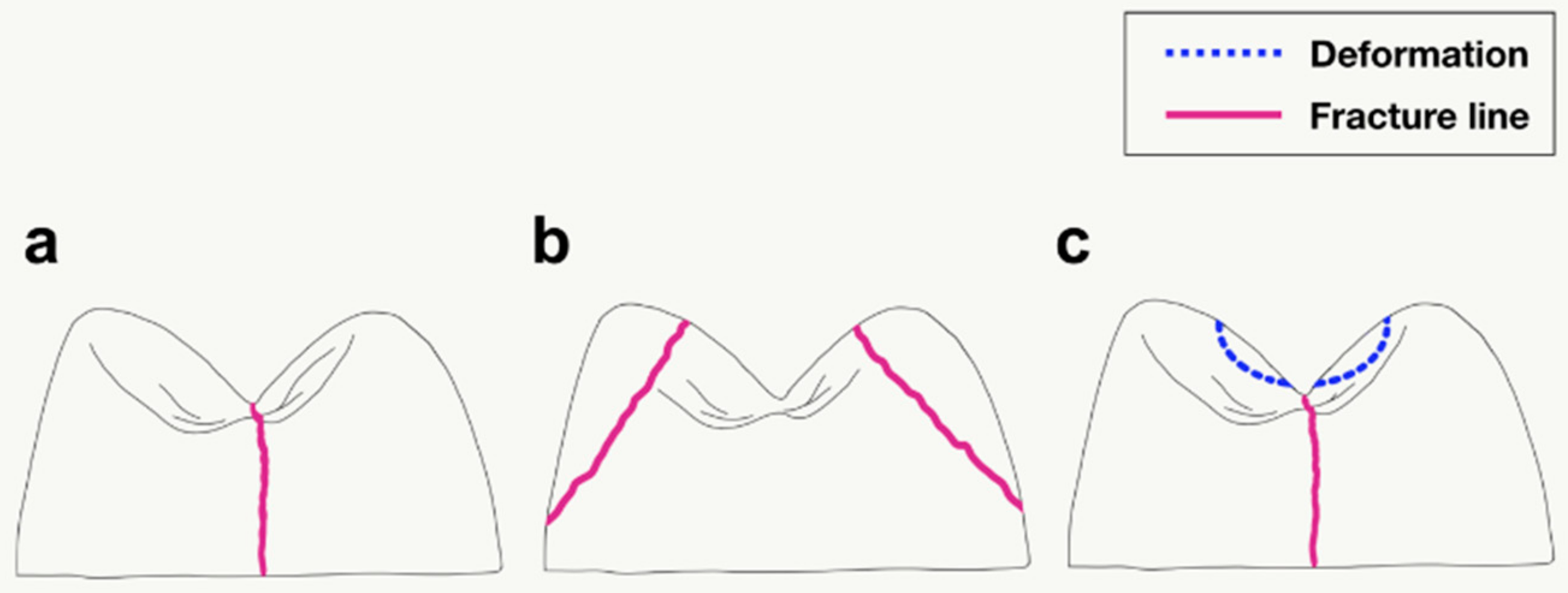 Materials 11 01798 g006