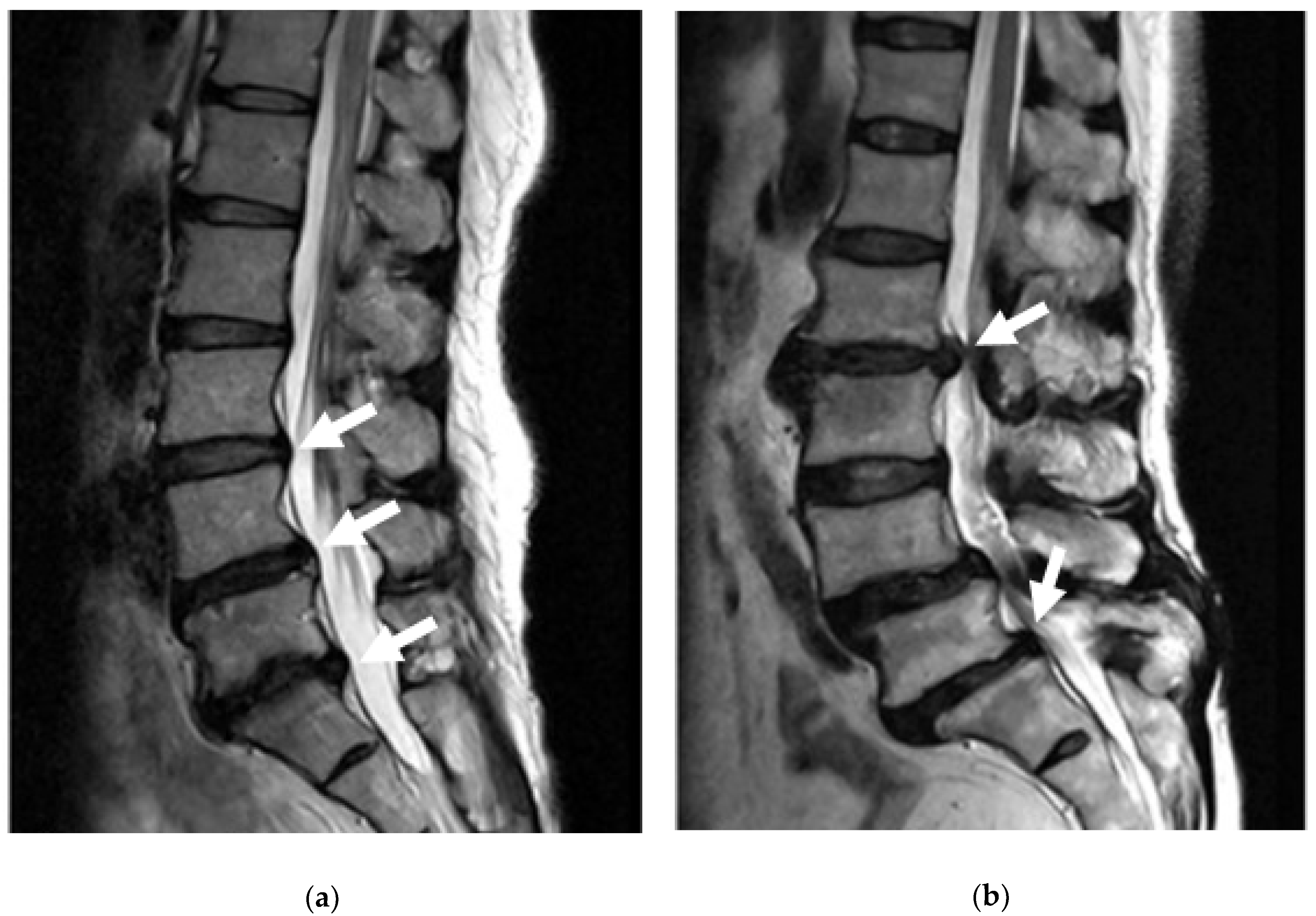 Materials Free Full Text Materials For The Spine Anatomy Problems And Solutions Html