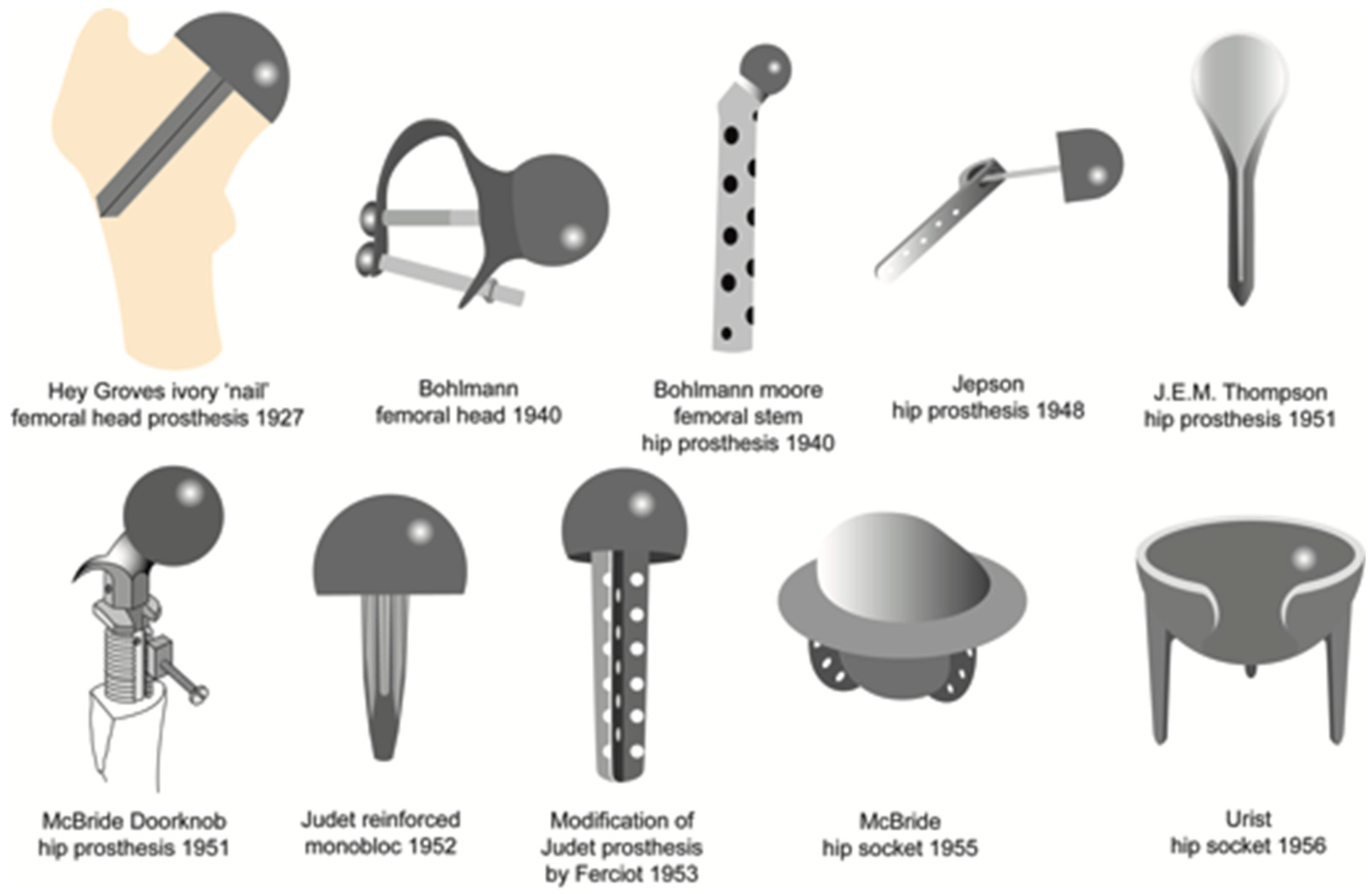 How To Sleep After Hip Replacement - EquipMeOT