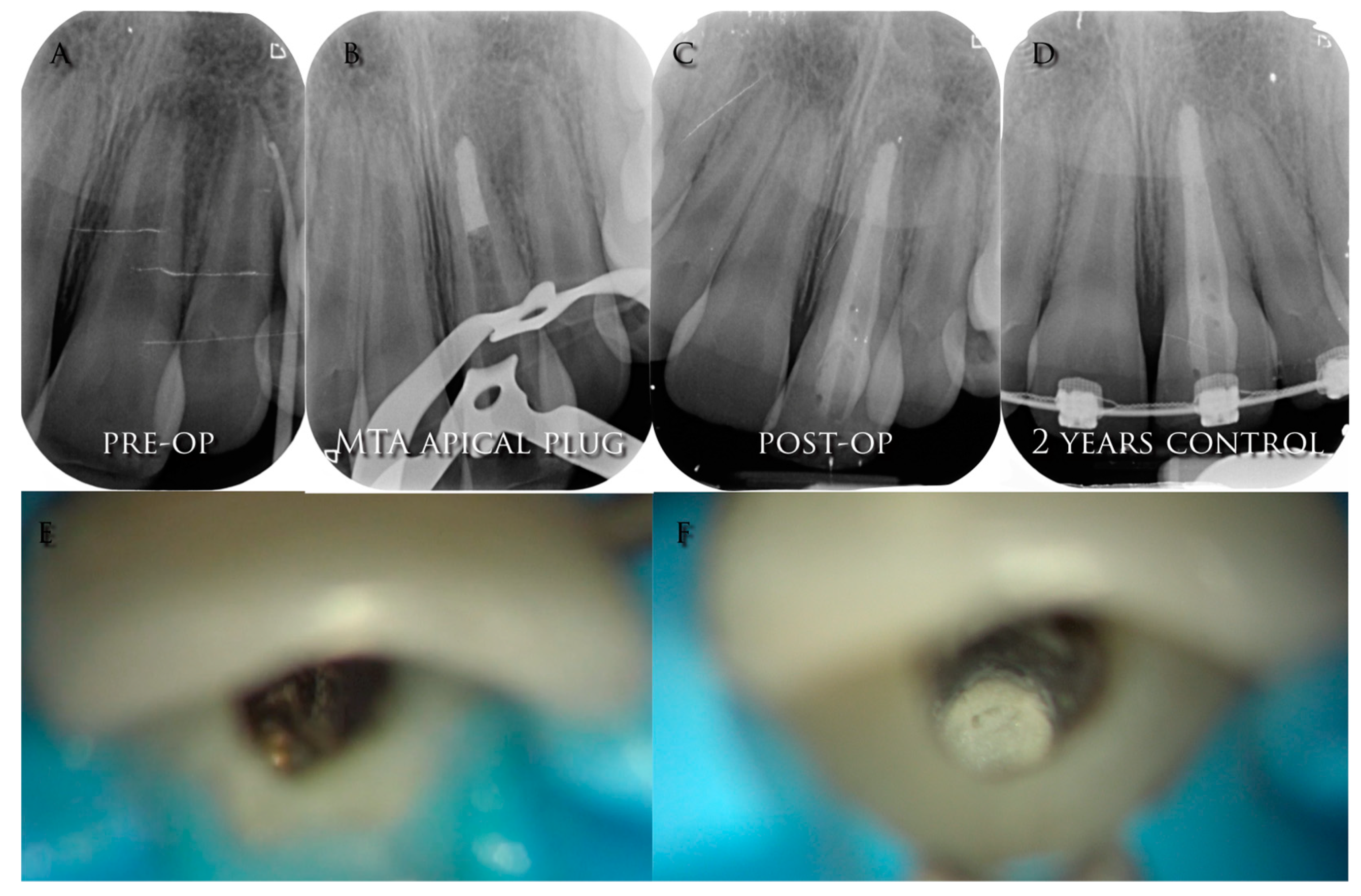 Materials 12 00908 g002