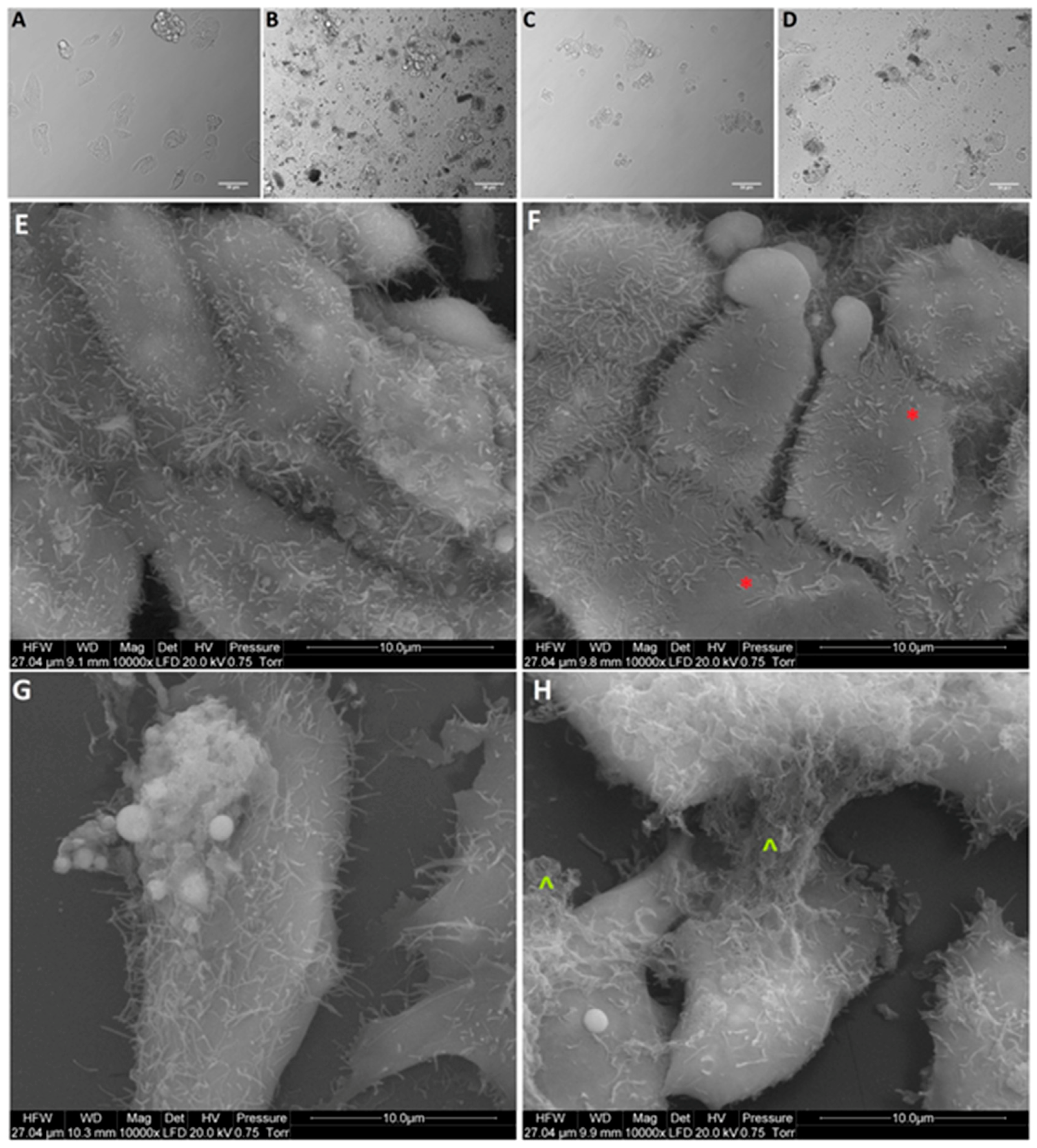 Materials 12 00909 g006