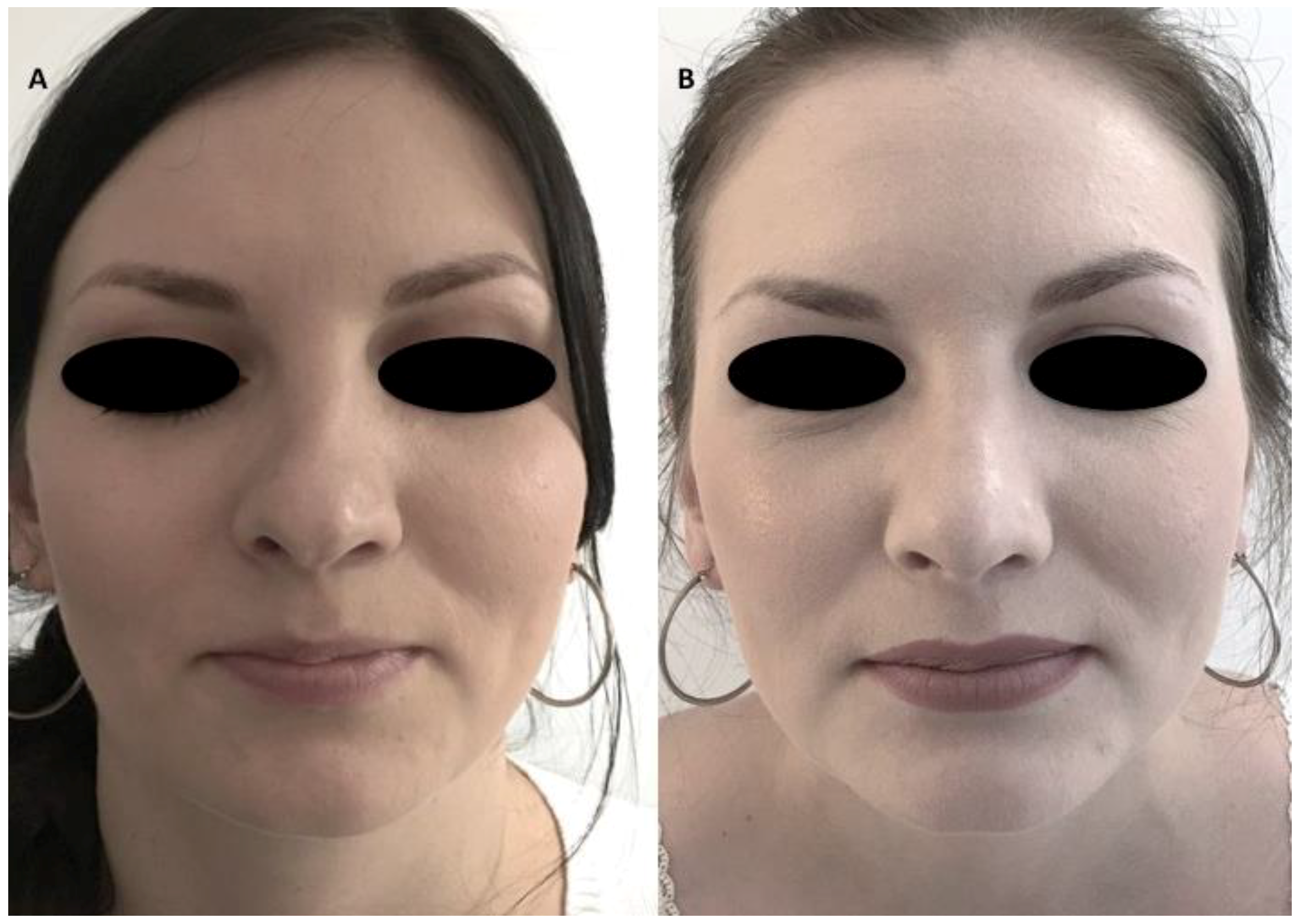 Materials 12 01062 g005