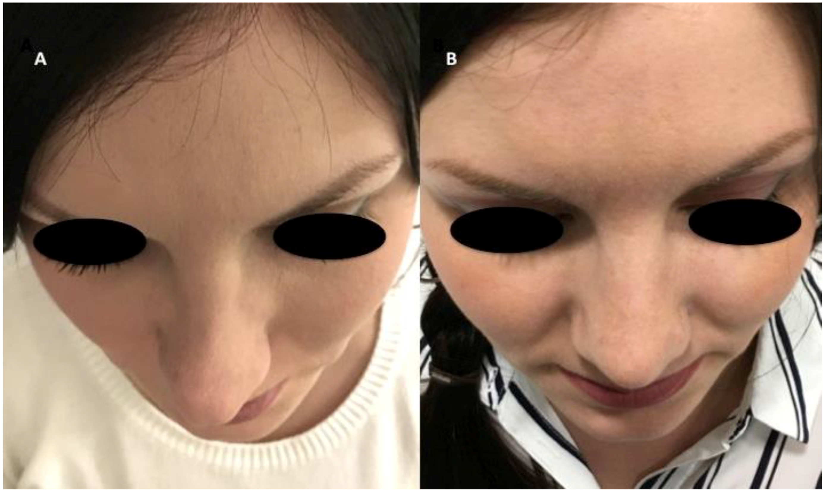 Materials 12 01062 g006