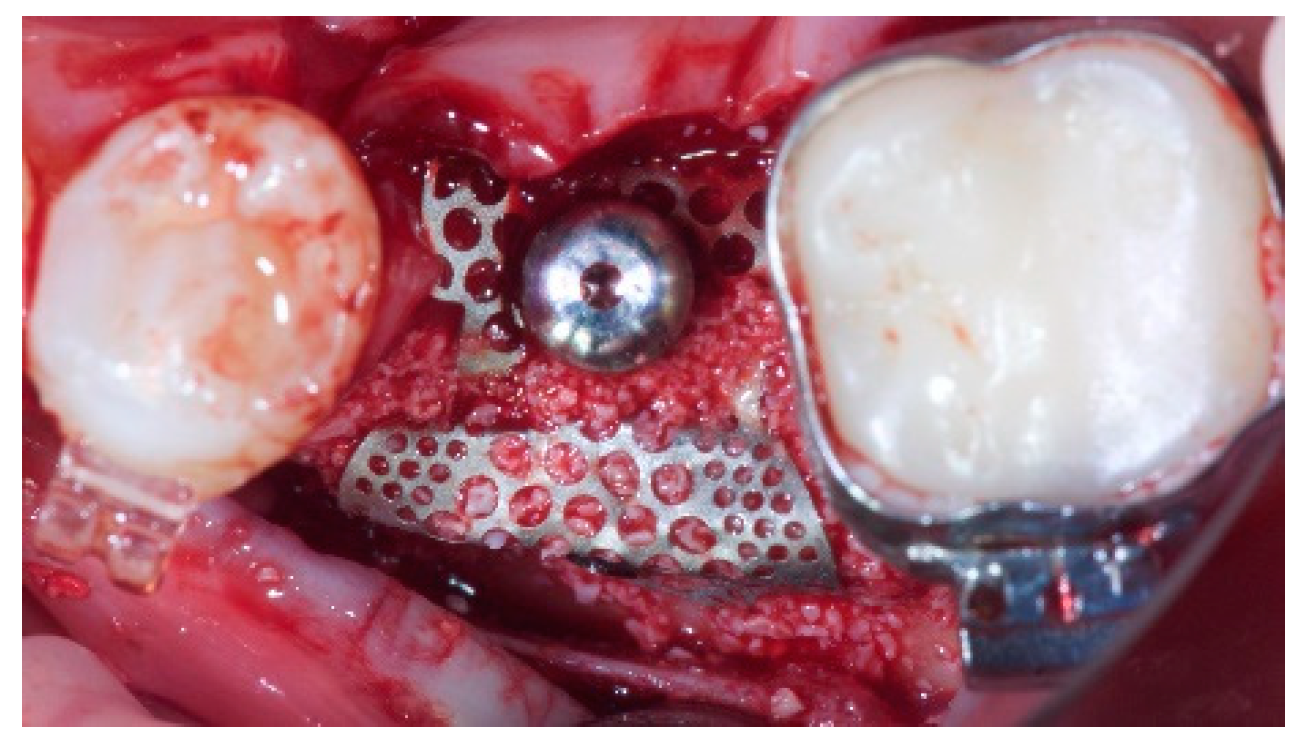 Materials 12 01710 g002