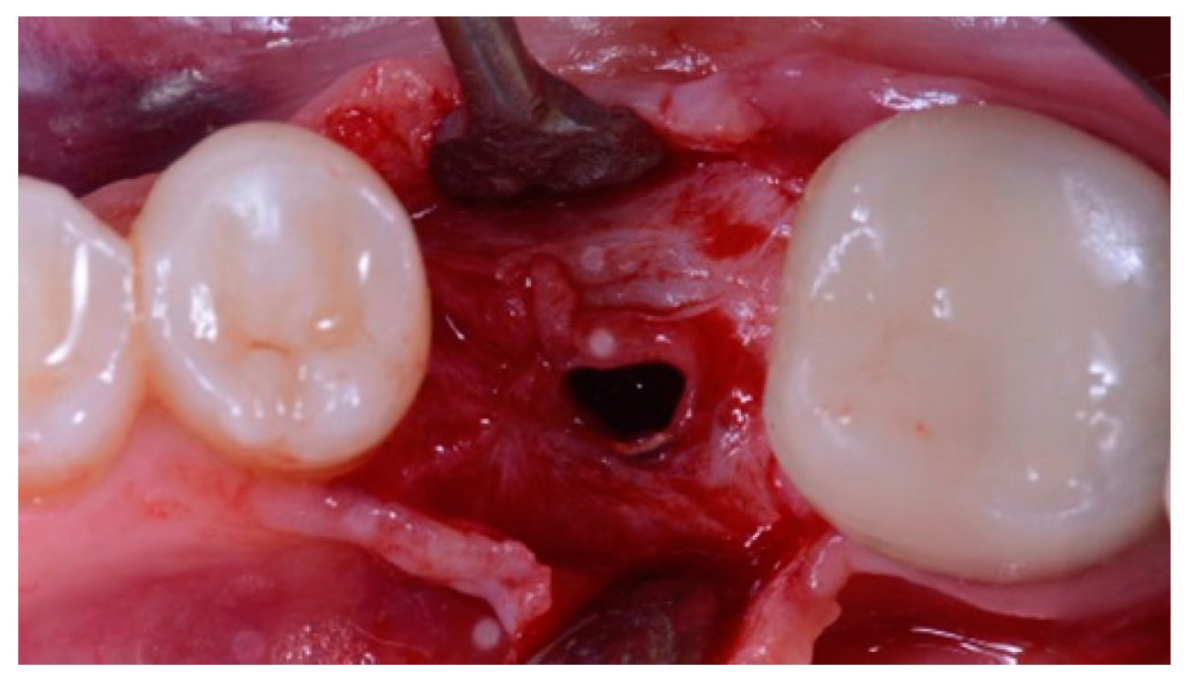 Materials 12 01710 g004