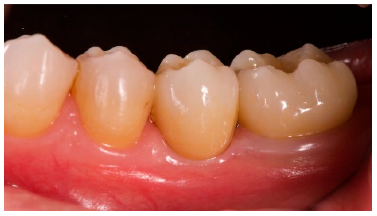 Materials 12 01710 g007