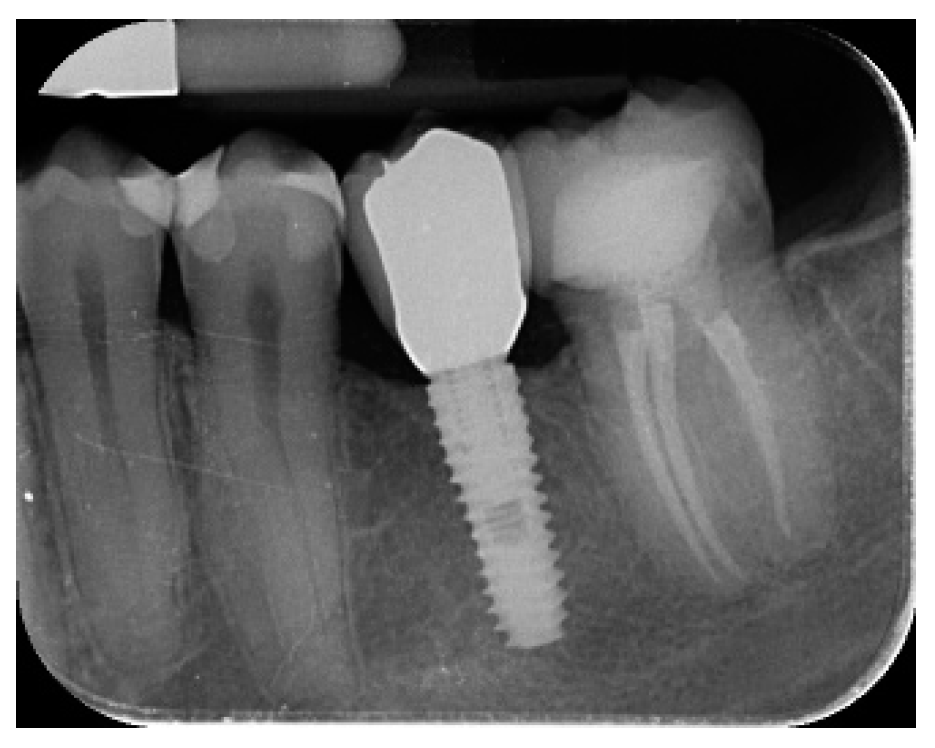 Materials 12 01710 g008