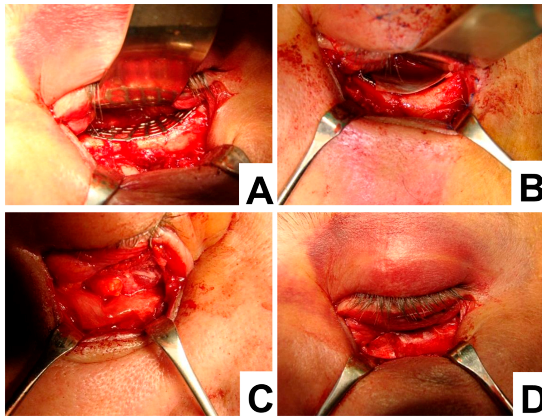 Materials 12 02343 g002