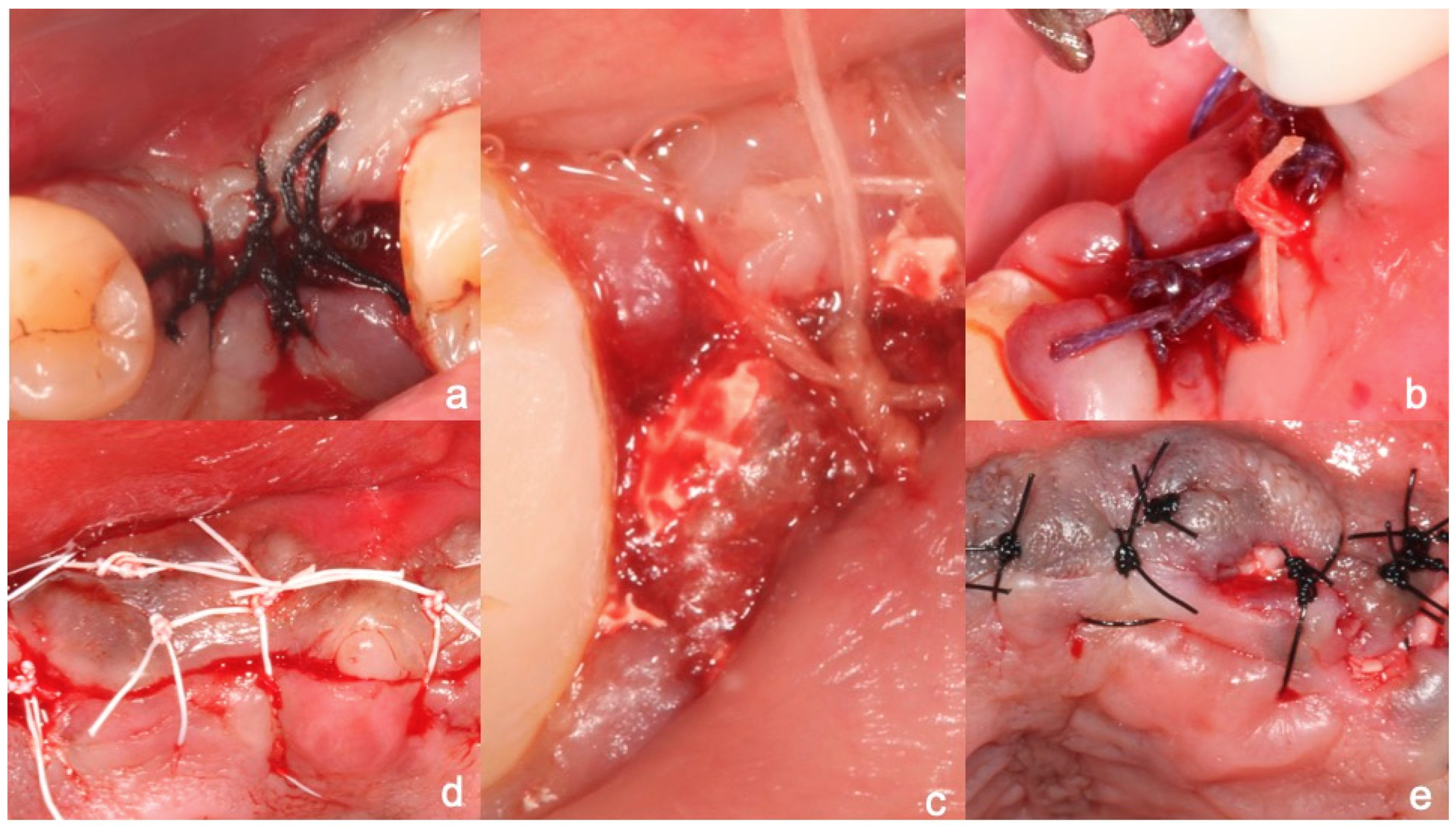 Materials 12 02848 g001 Materials 12 02848 g001