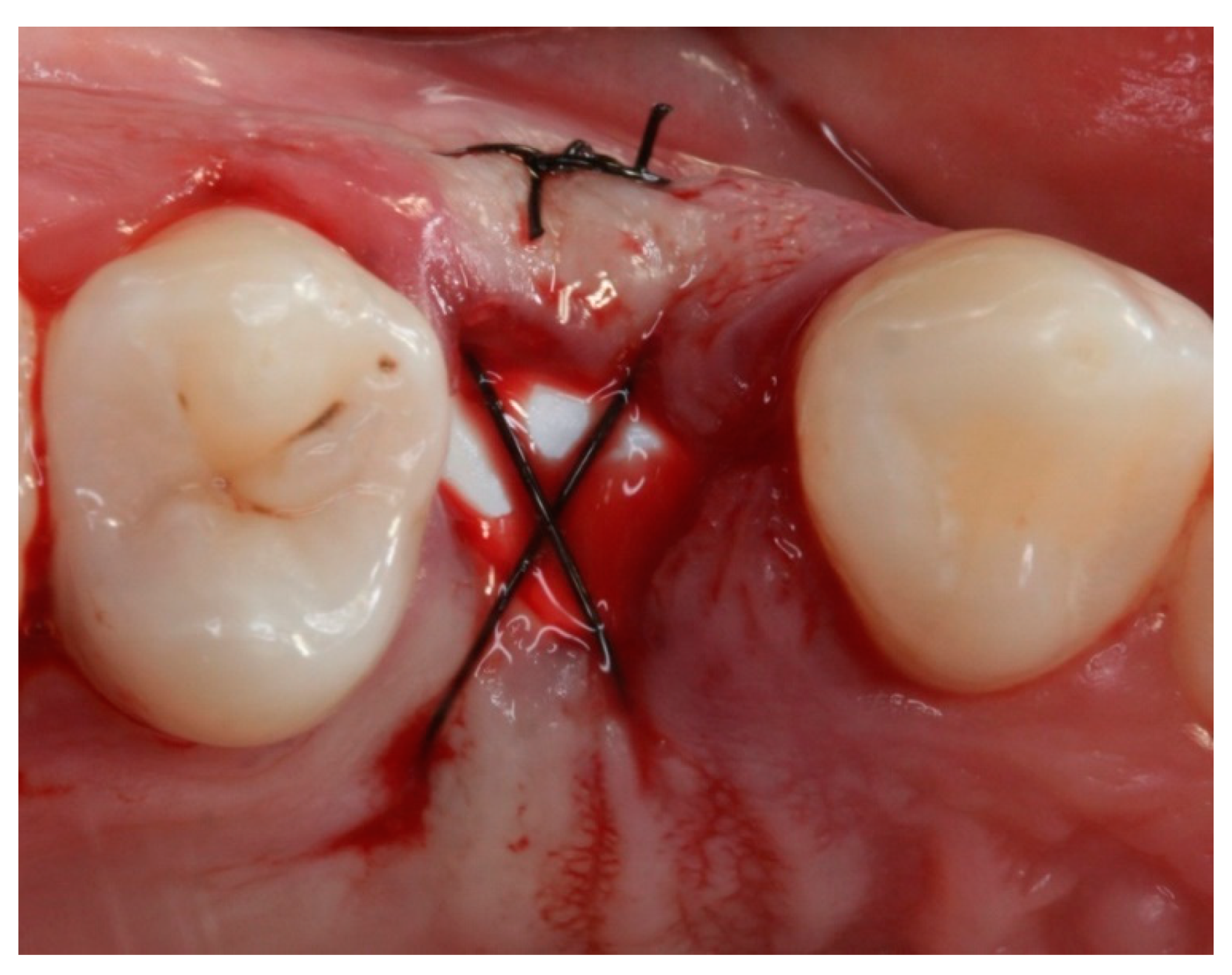 Materials 12 02902 g005